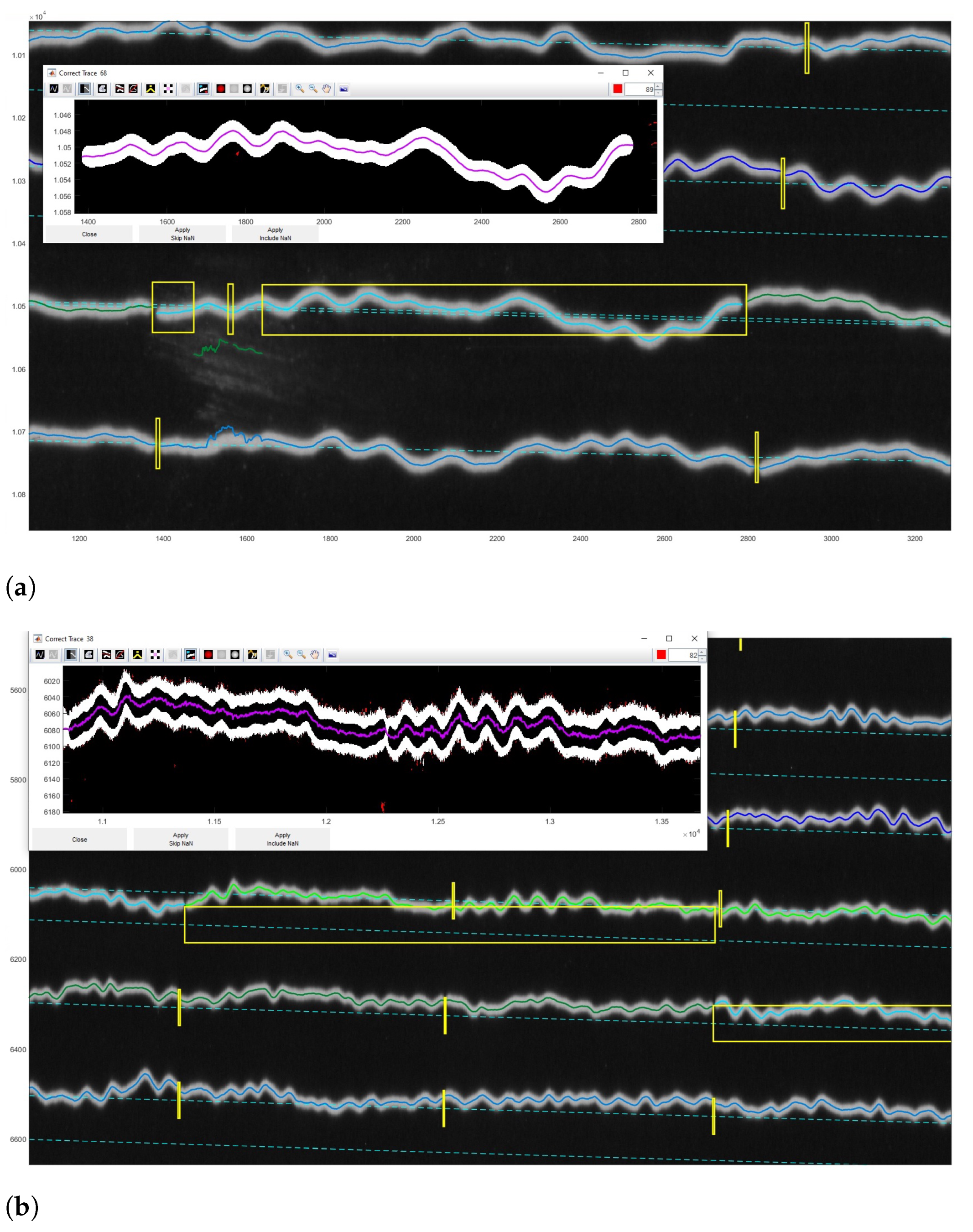 Sensors 23 00056 g015