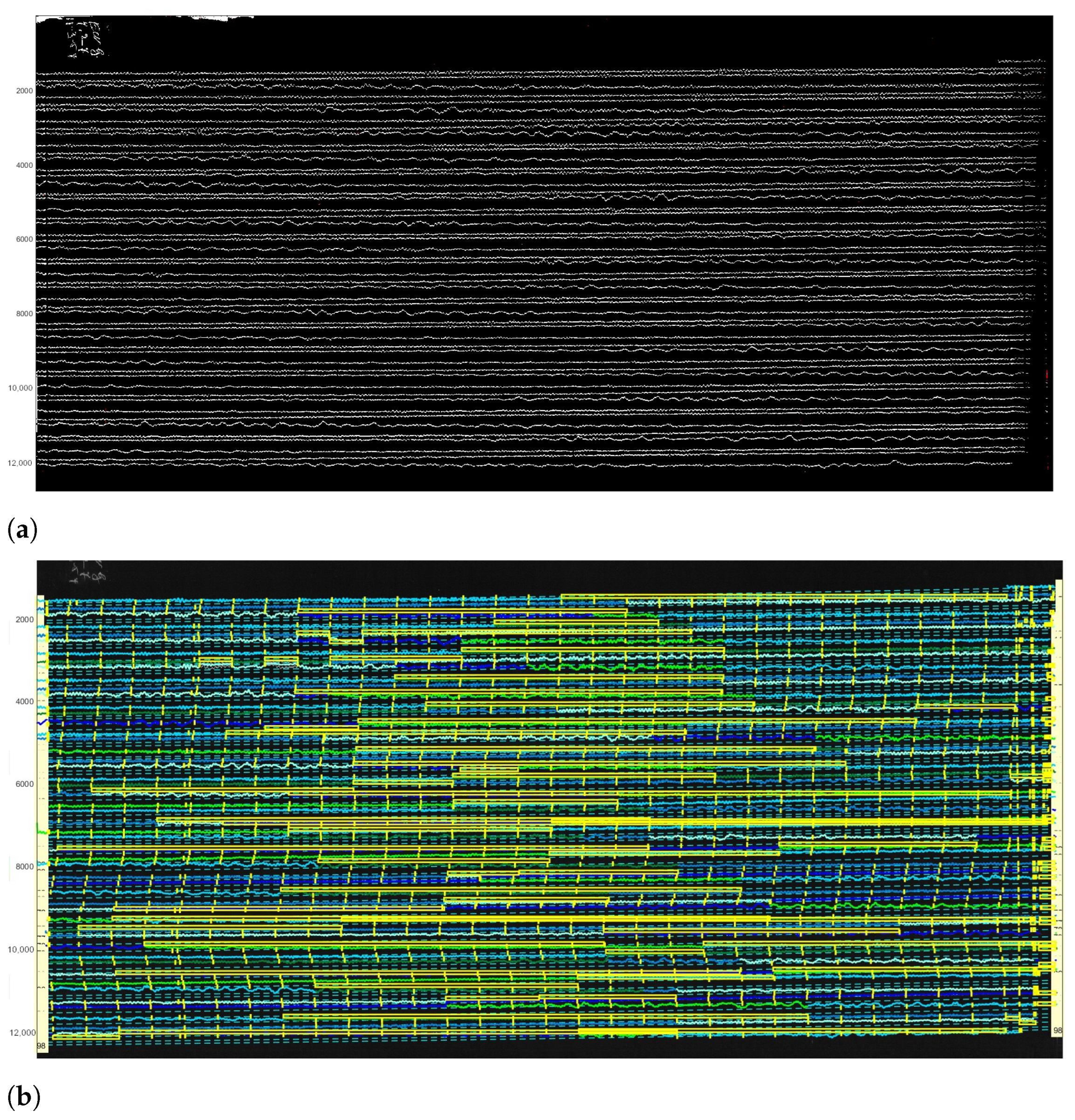 Sensors 23 00056 g017