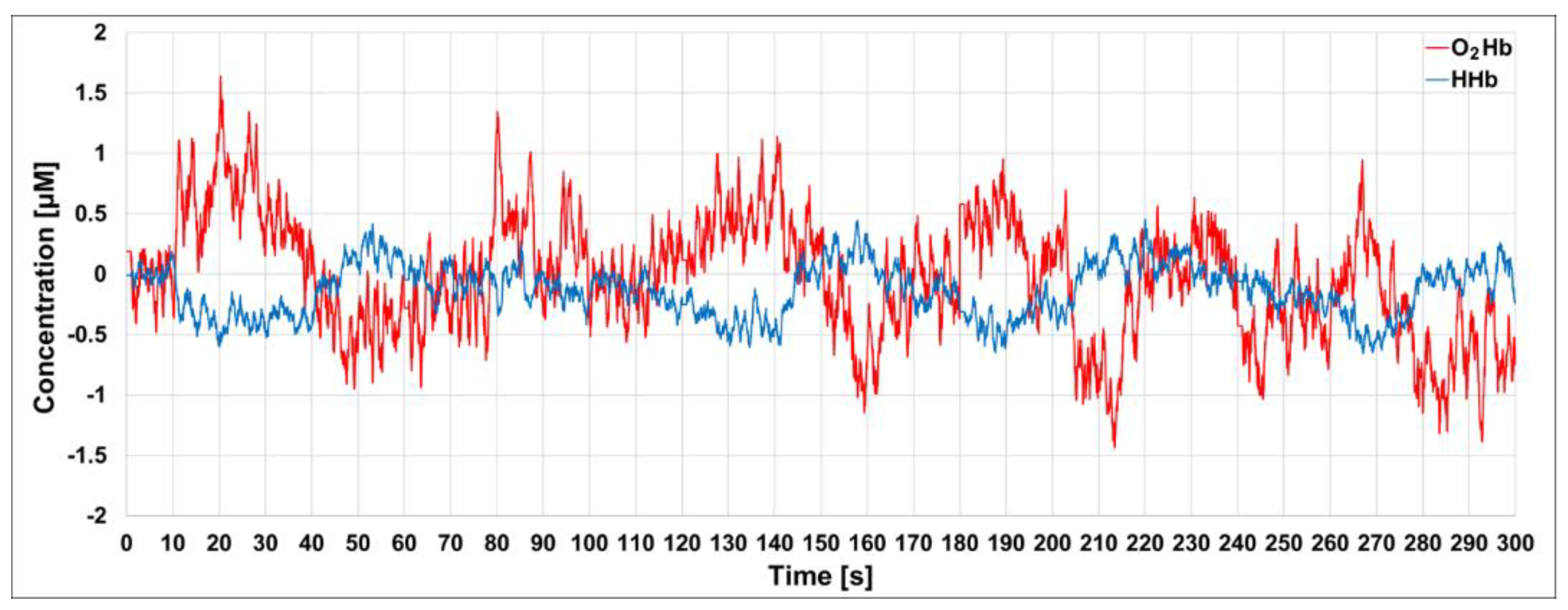 Sensors 23 00196 g008 Sensors 23 00196 g008