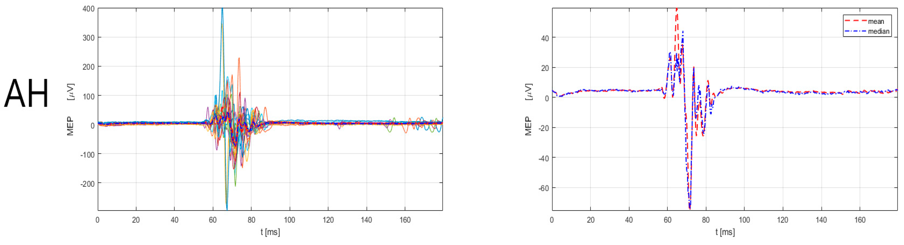 Sensors 23 00497 g004