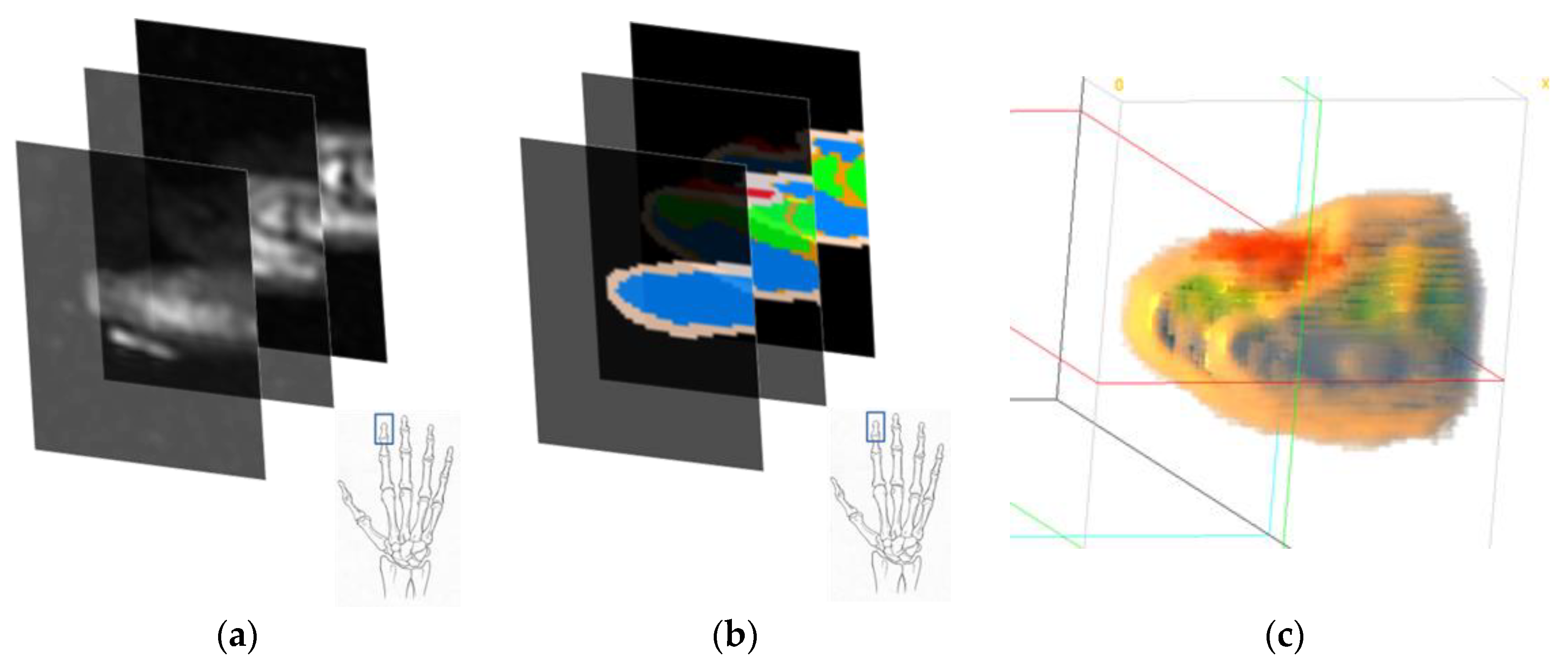 Sensors 23 00540 g006