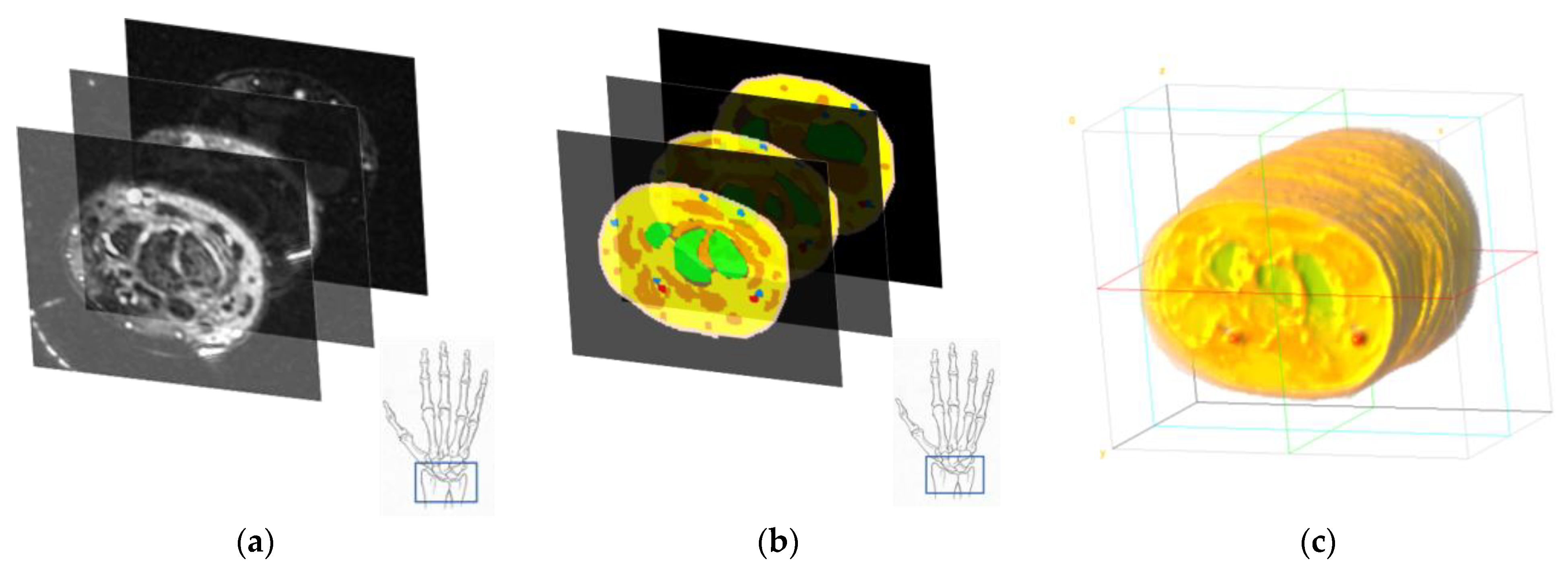 Sensors 23 00540 g007