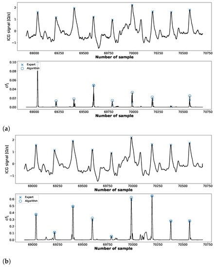 Sensors 23 00675 g0a1