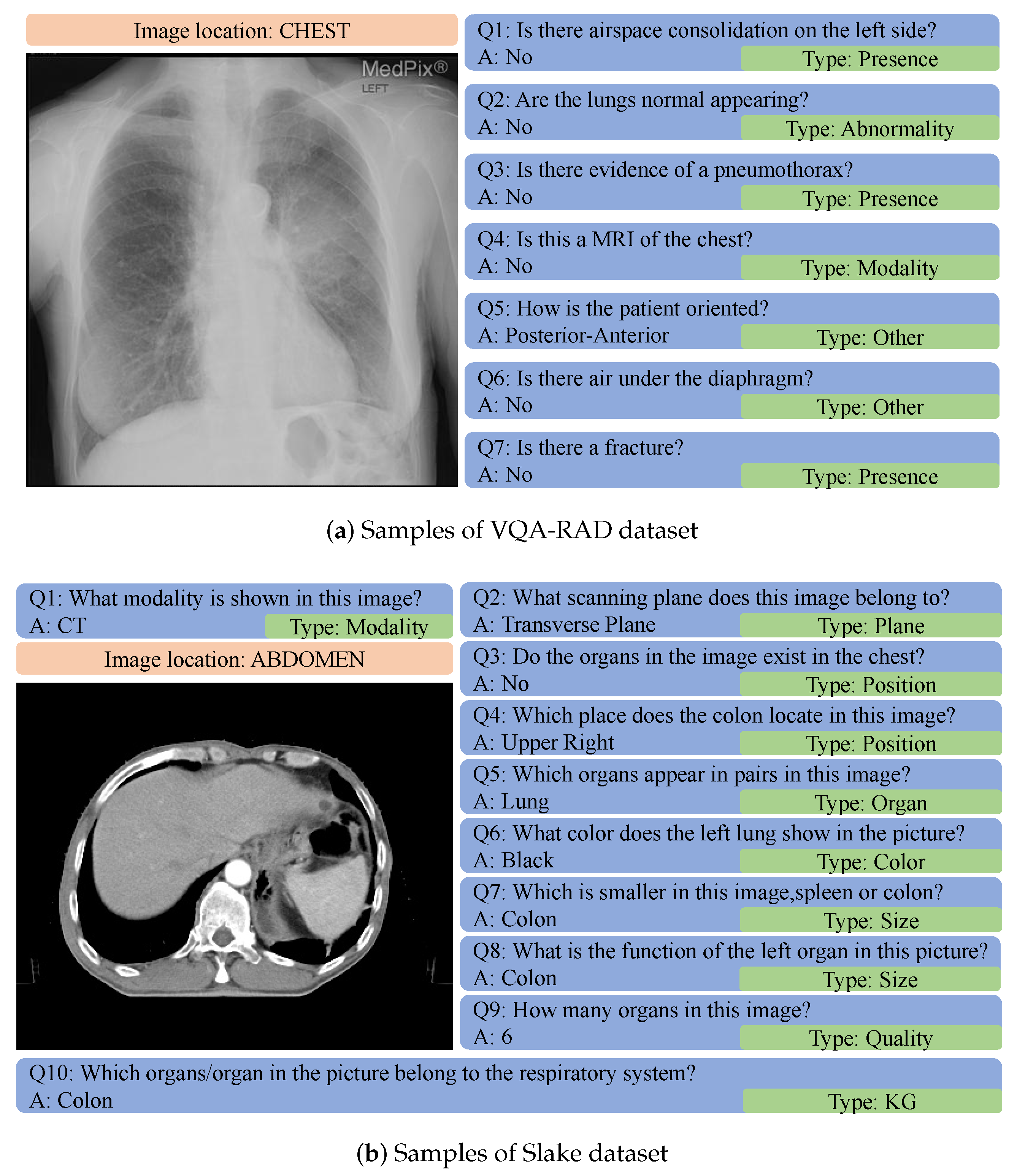 Sensors 23 01057 g002