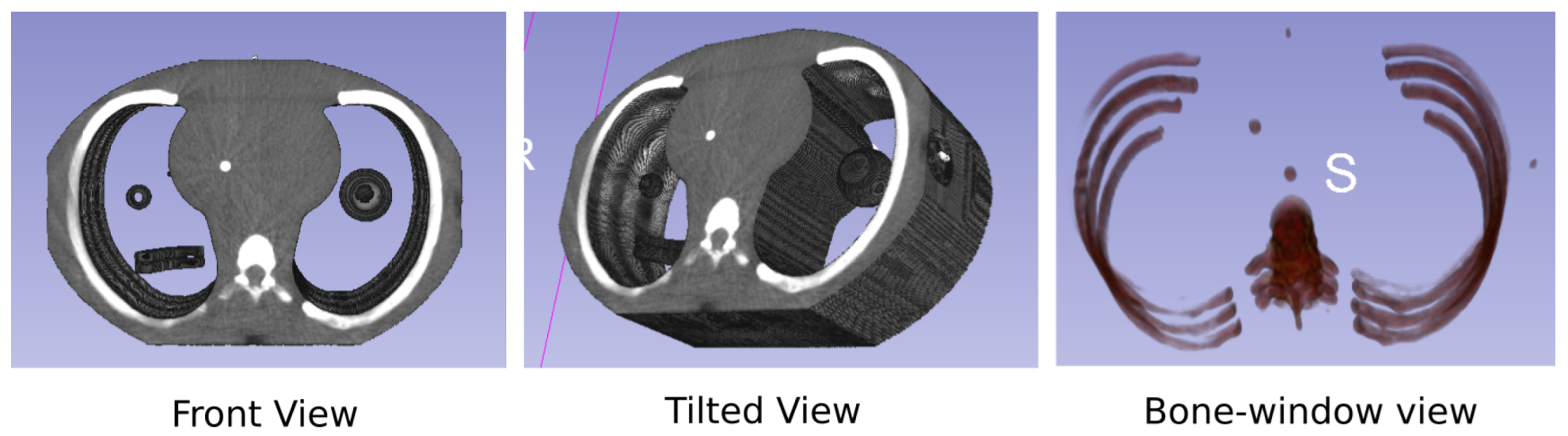 Sensors 23 01089 g003