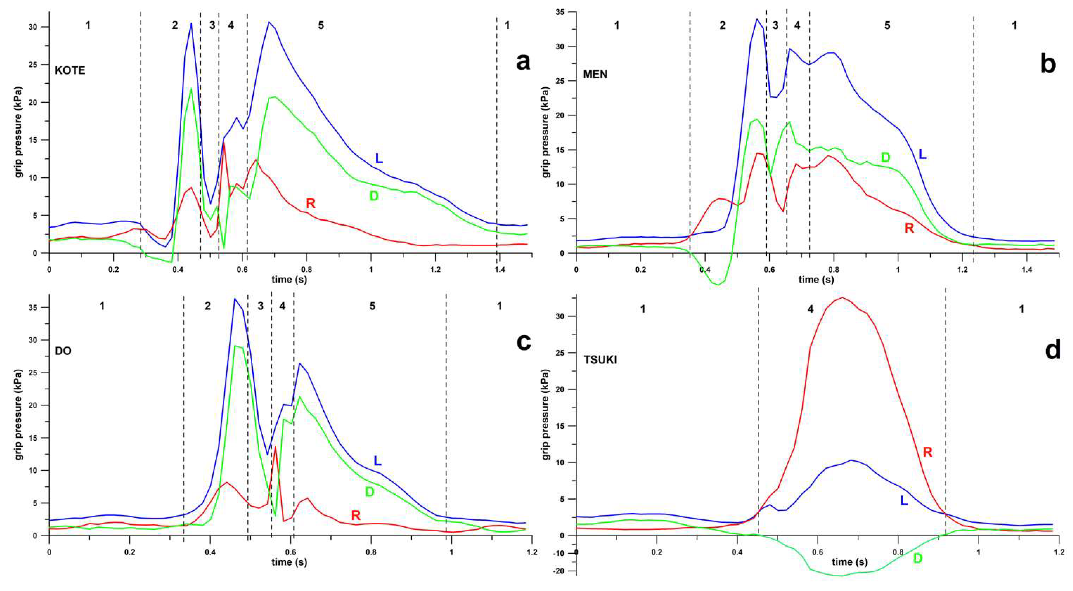 Sensors 23 01189 g004 Sensors 23 01189 g004