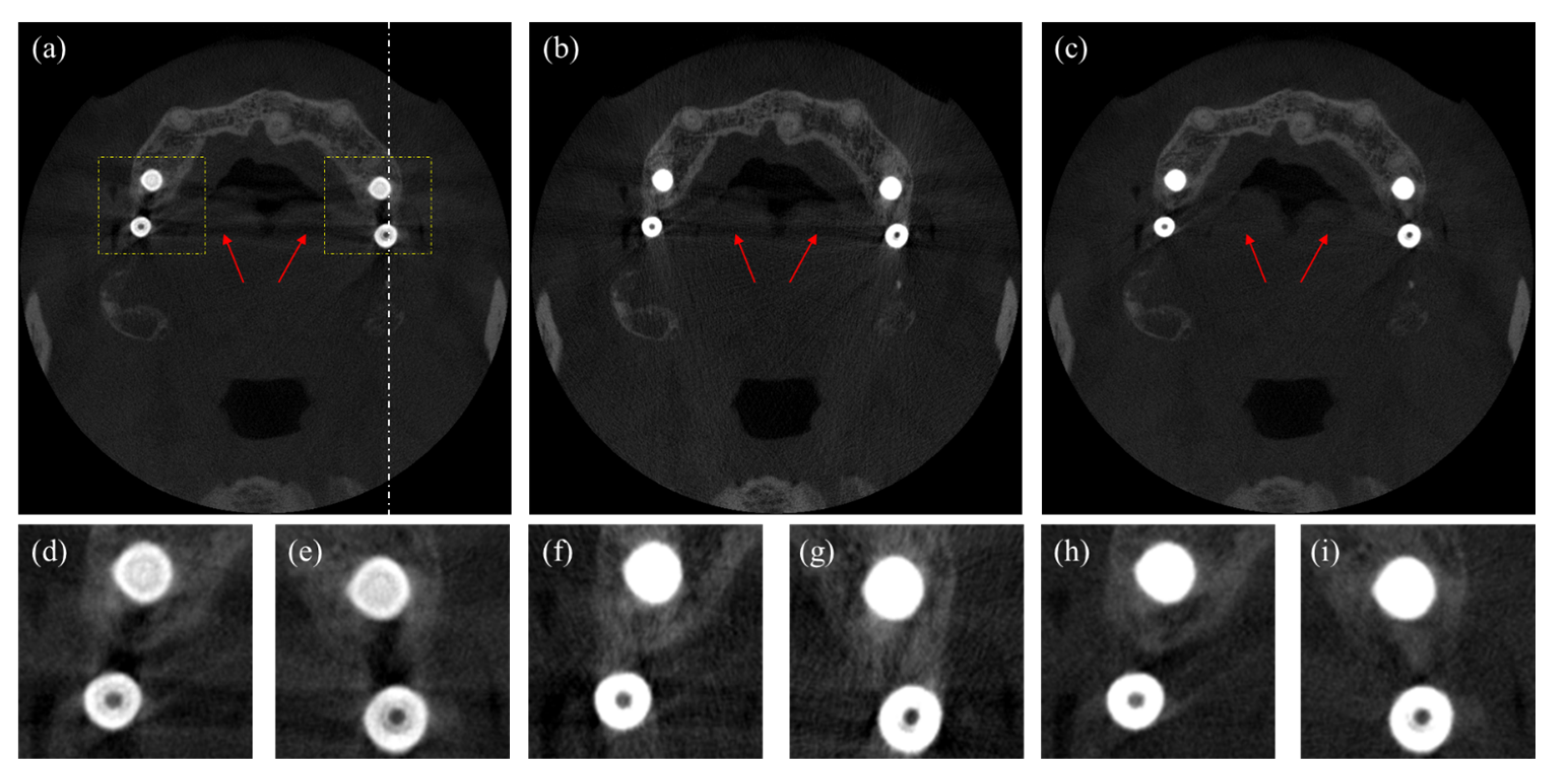 Sensors 23 01288 g010