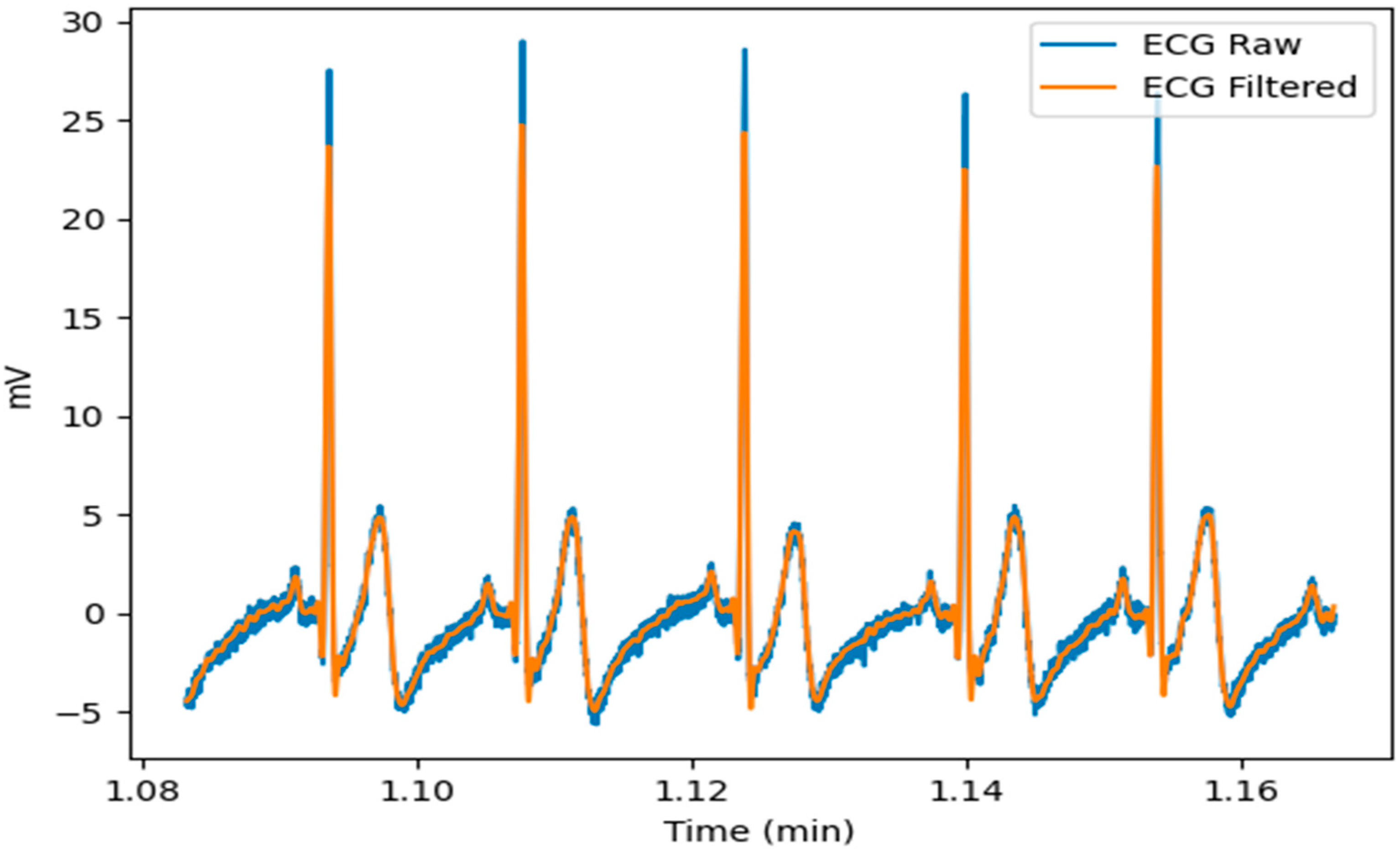 Sensors 23 01443 g004 Sensors 23 01443 g004