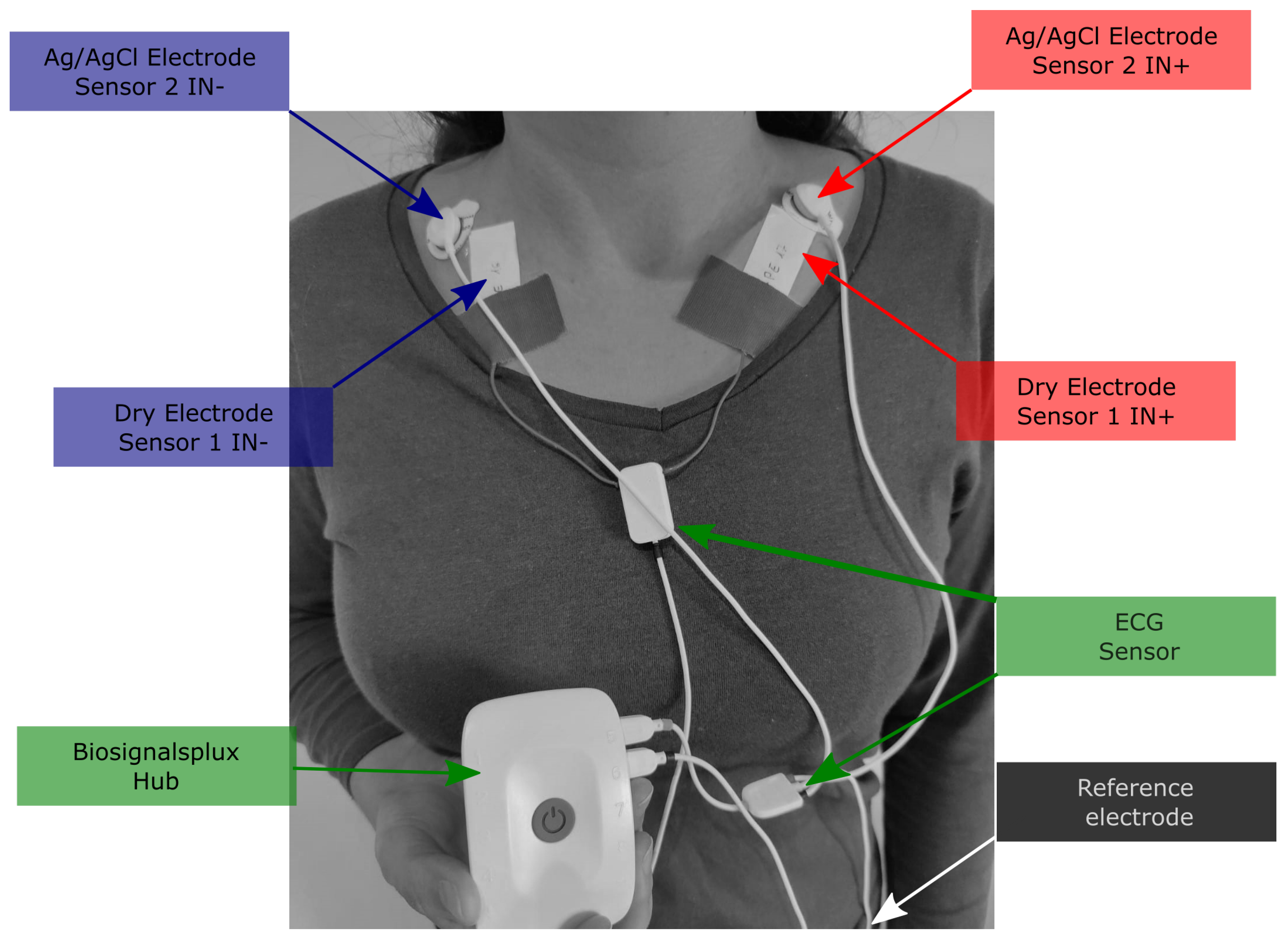 Sensors 23 01468 g003