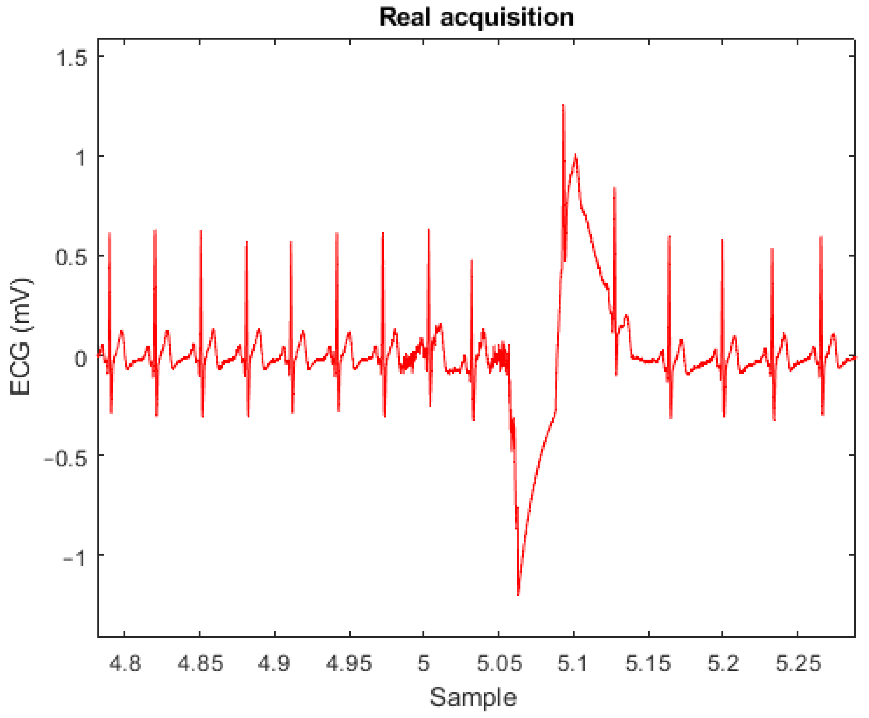 Sensors 23 01468 g005