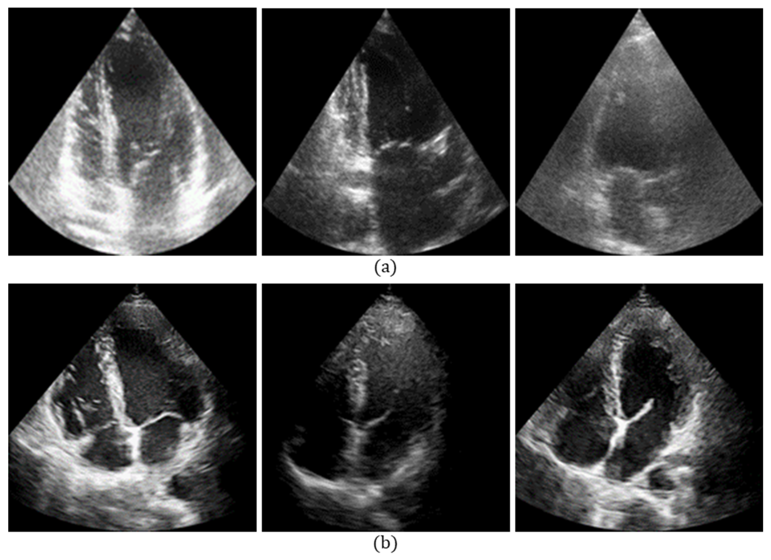 Cross-Domain Echocardiography Segmentation with Multi-Space Joint ...