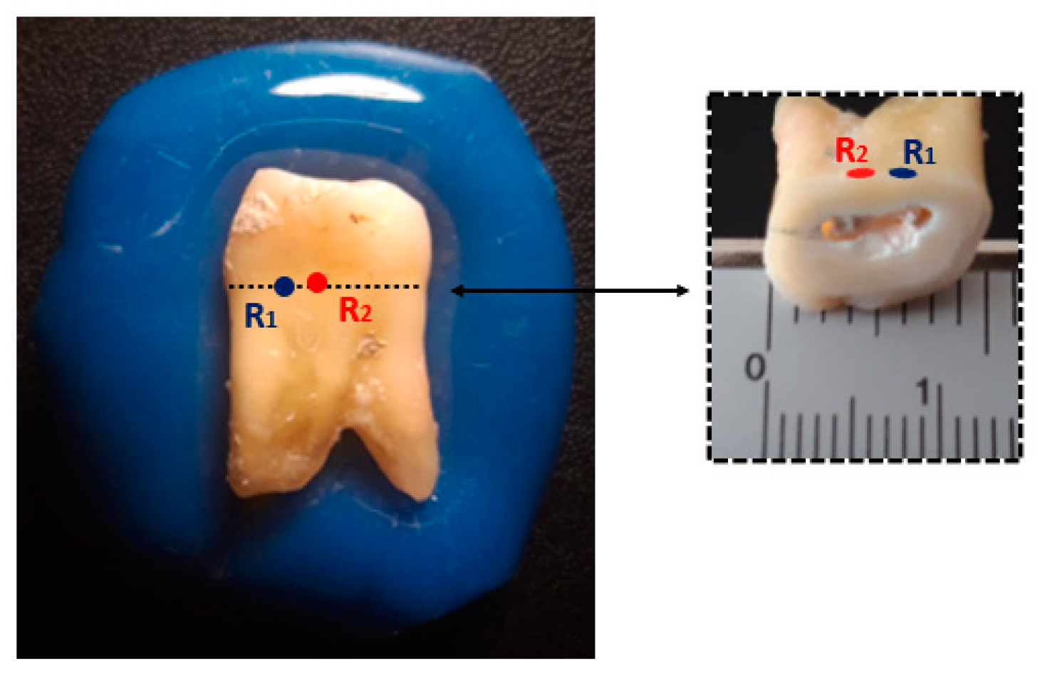 Sensors 23 01617 g007 Sensors 23 01617 g007