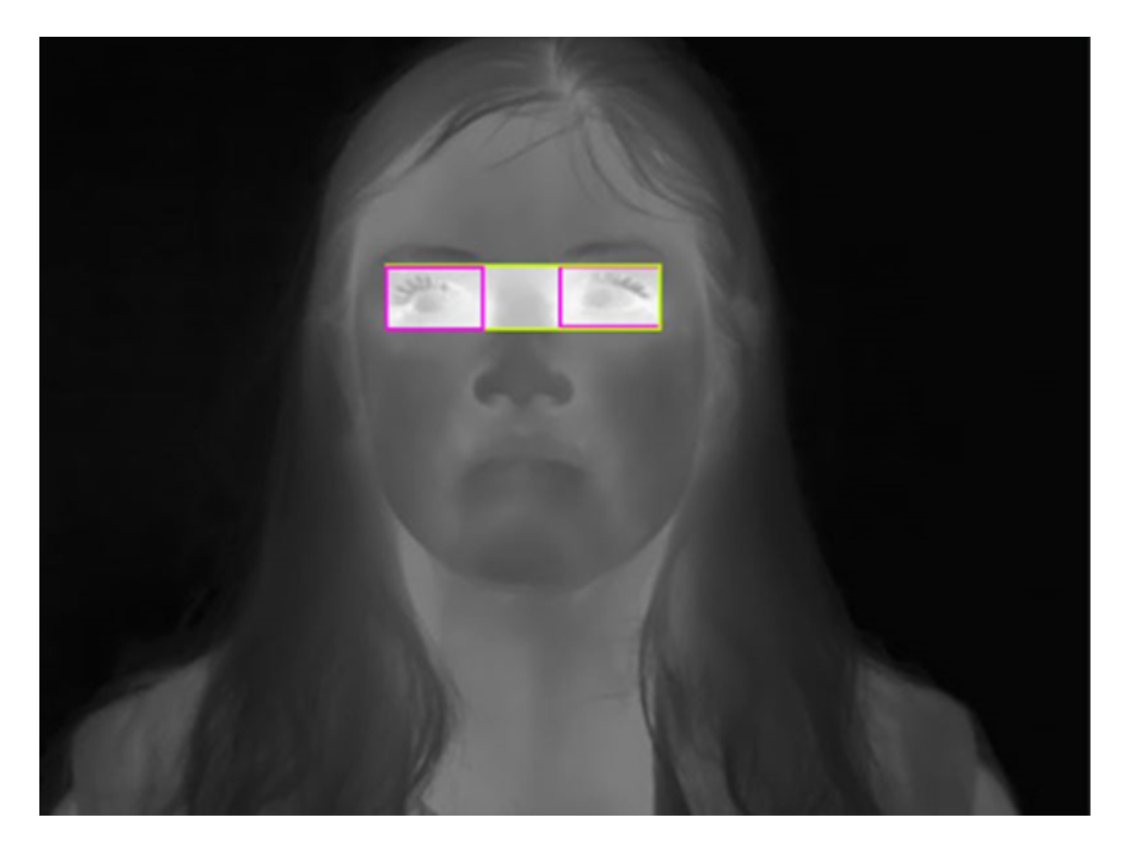 Sensors 23 01851 g003