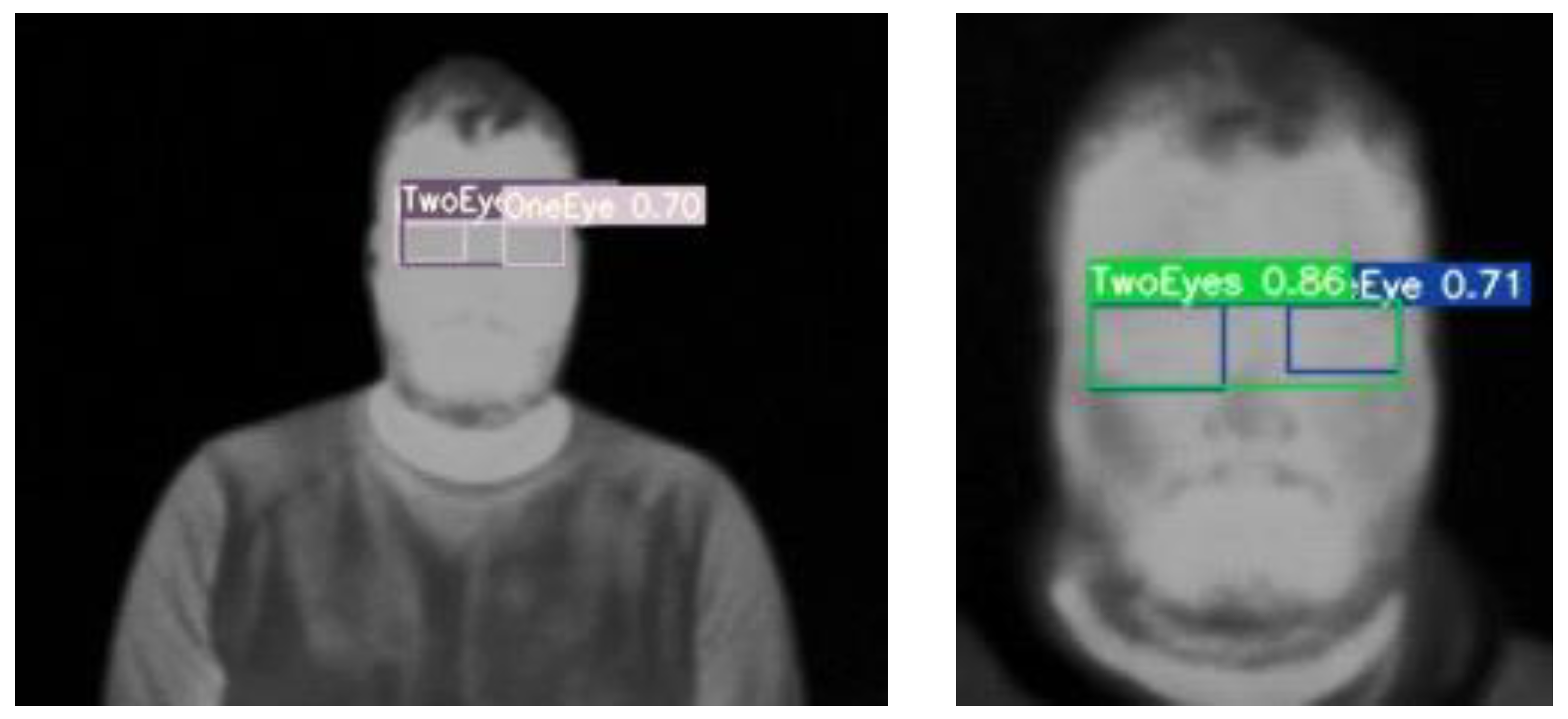 Sensors 23 01851 g015