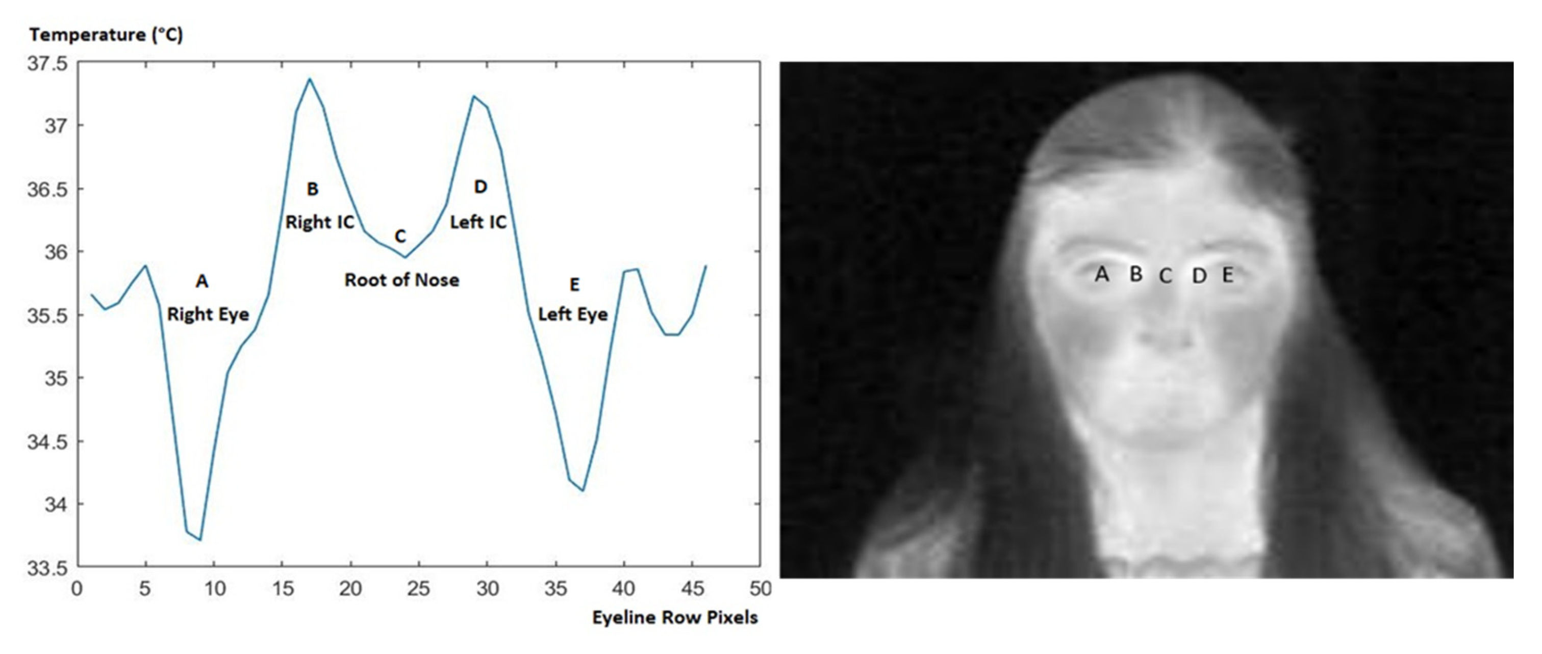 Sensors 23 01851 g016