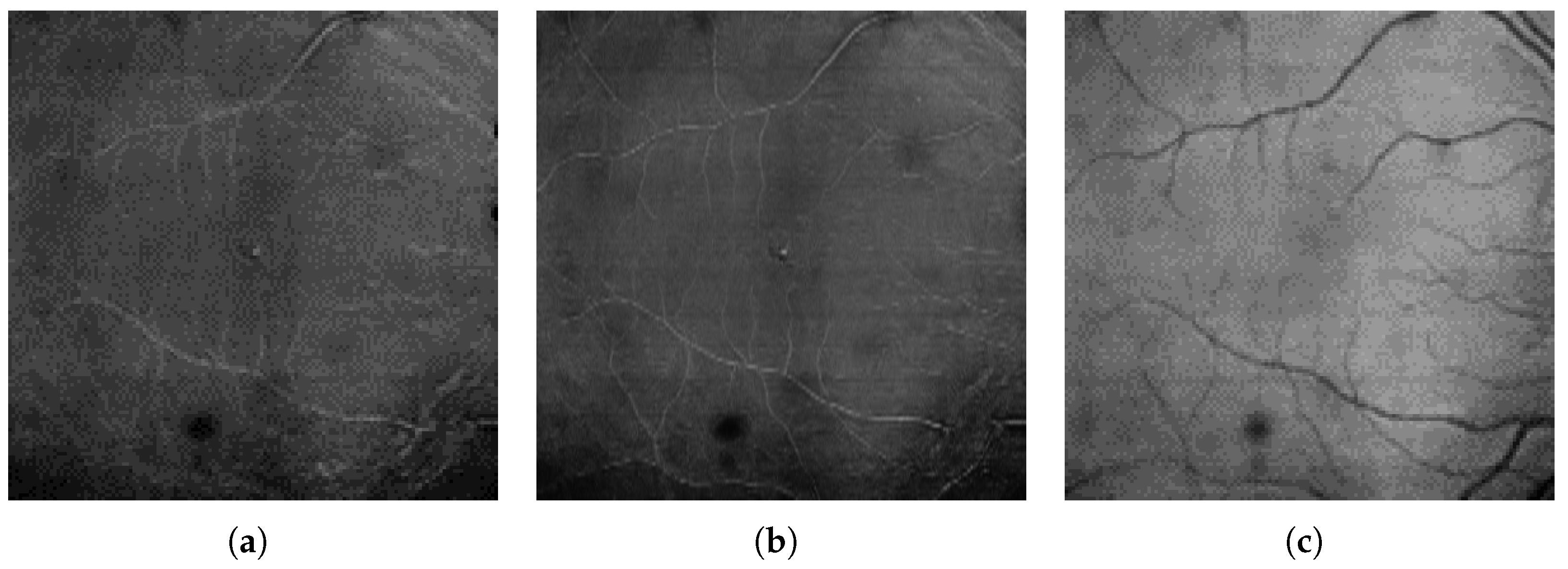 Sensors 23 01870 g003
