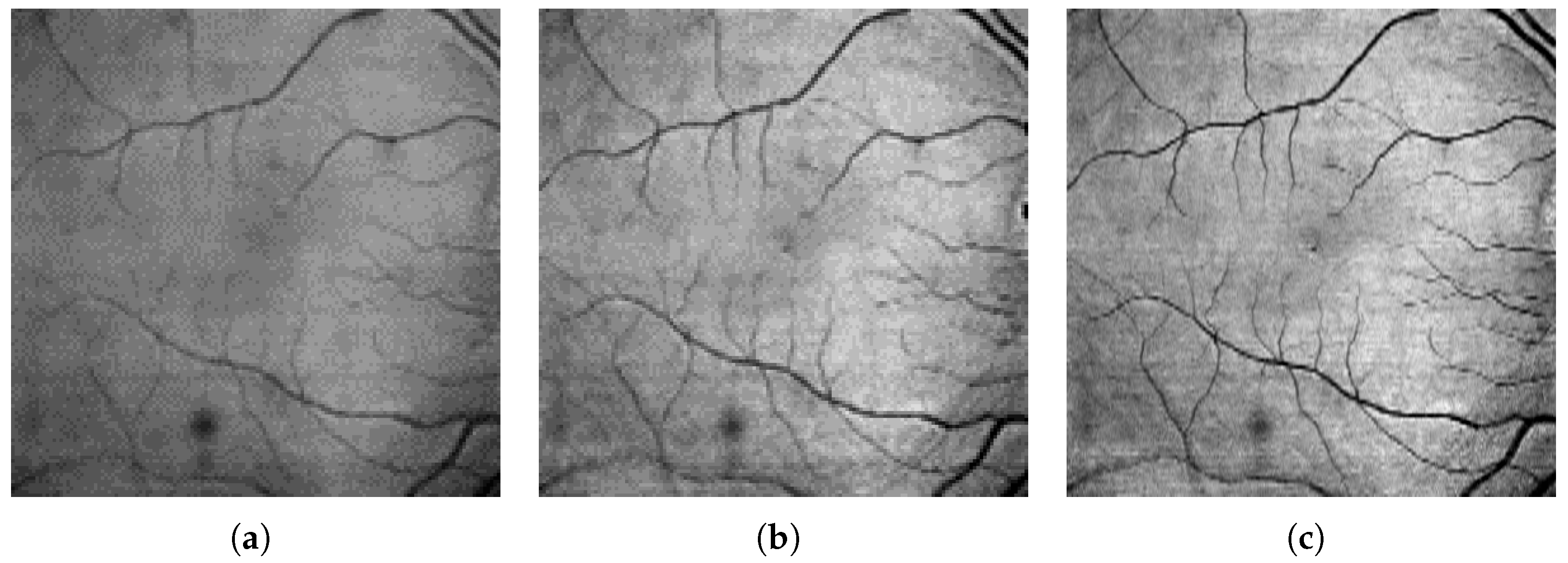Sensors 23 01870 g004