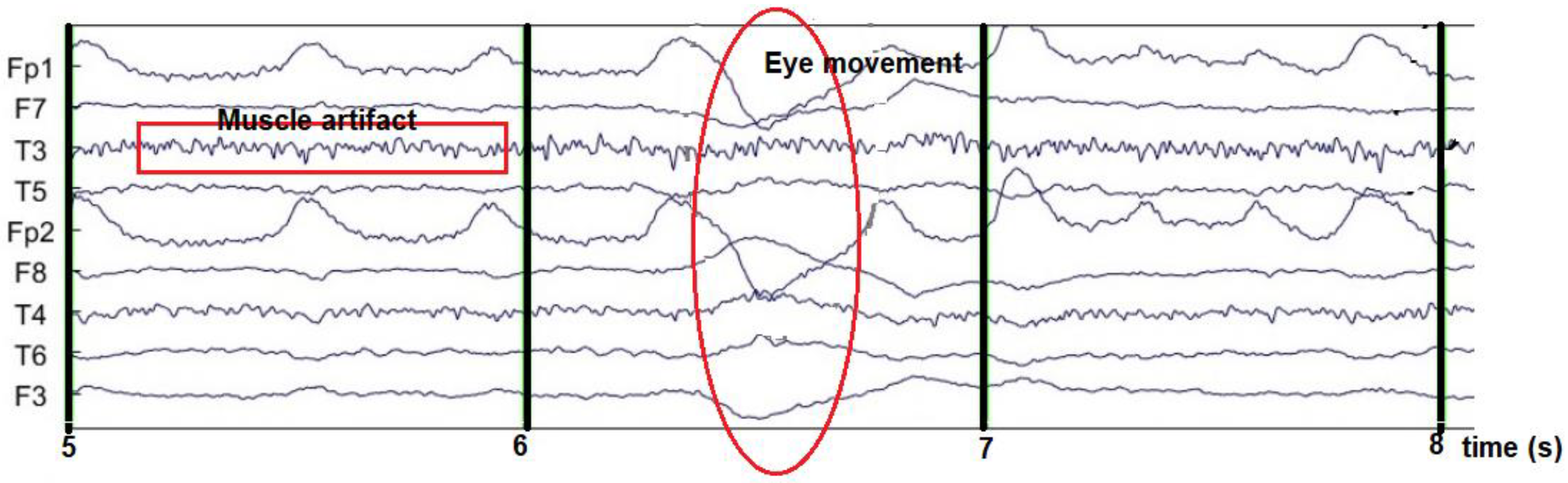 Sensors 23 01900 g005