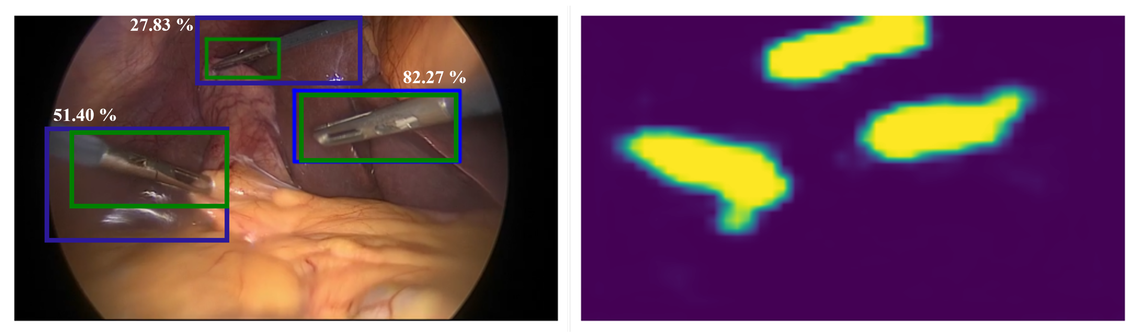 Sensors 23 01958 g007