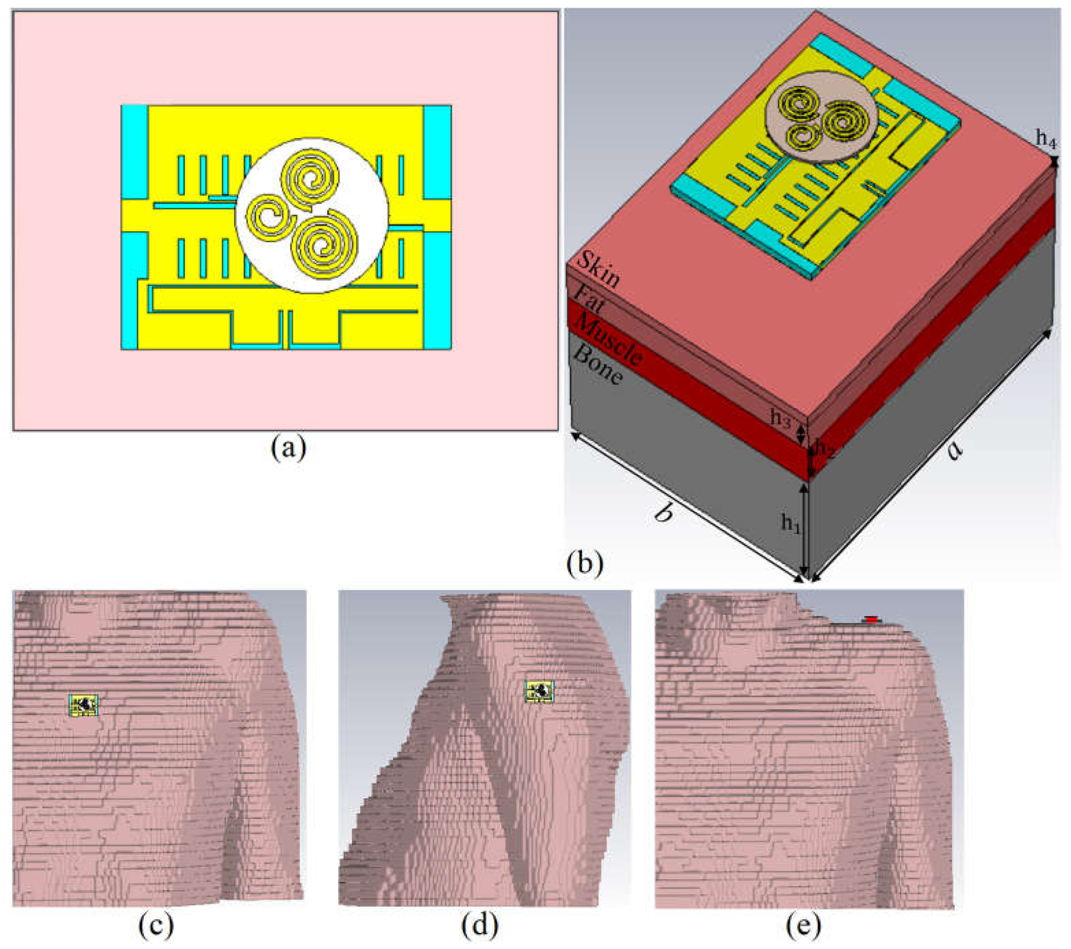 Sensors 23 01997 g012
