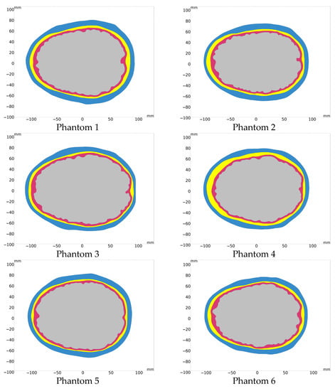 Sensors 23 02031 g0a1a 550