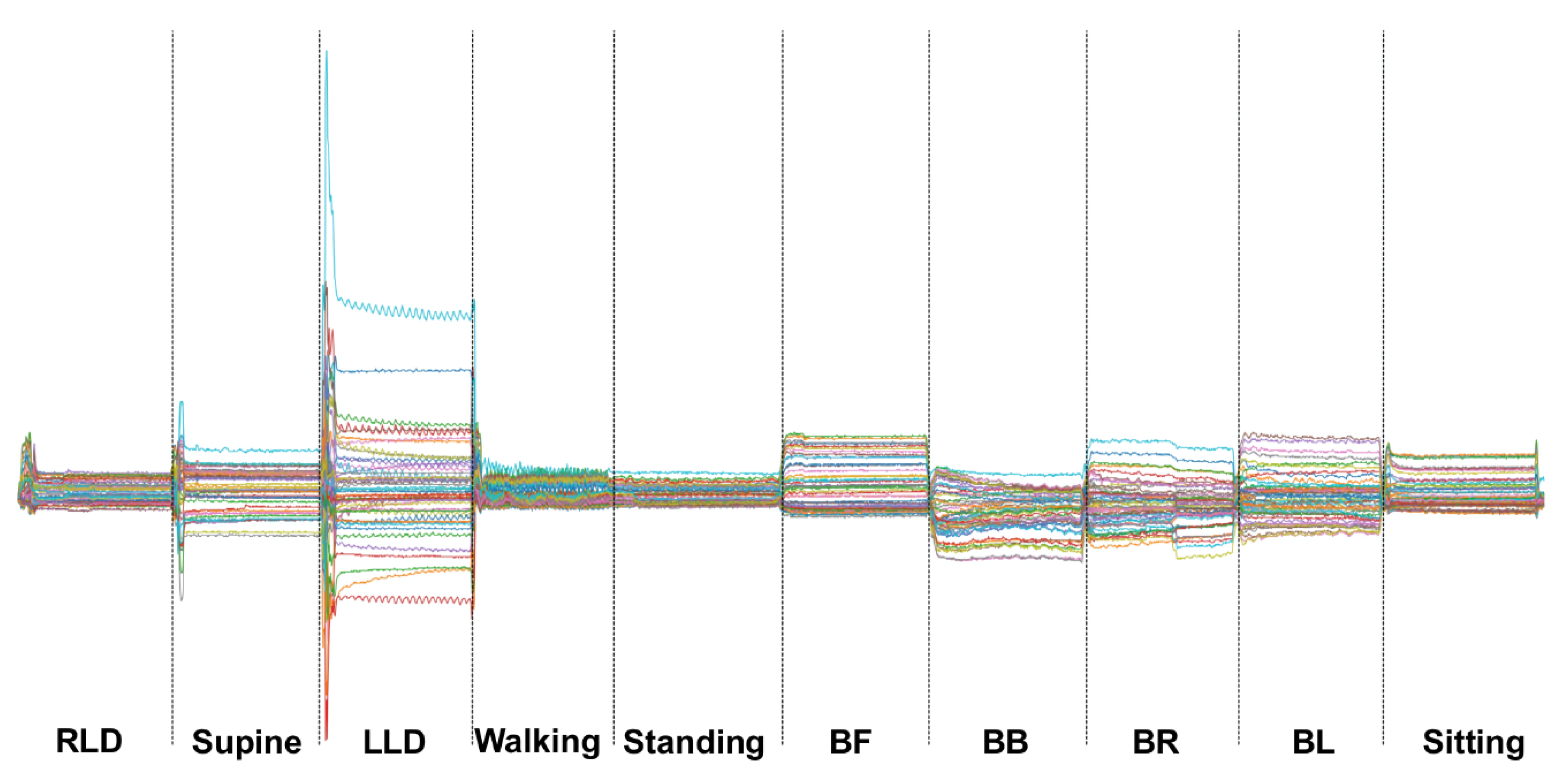 Sensors 23 02066 g004