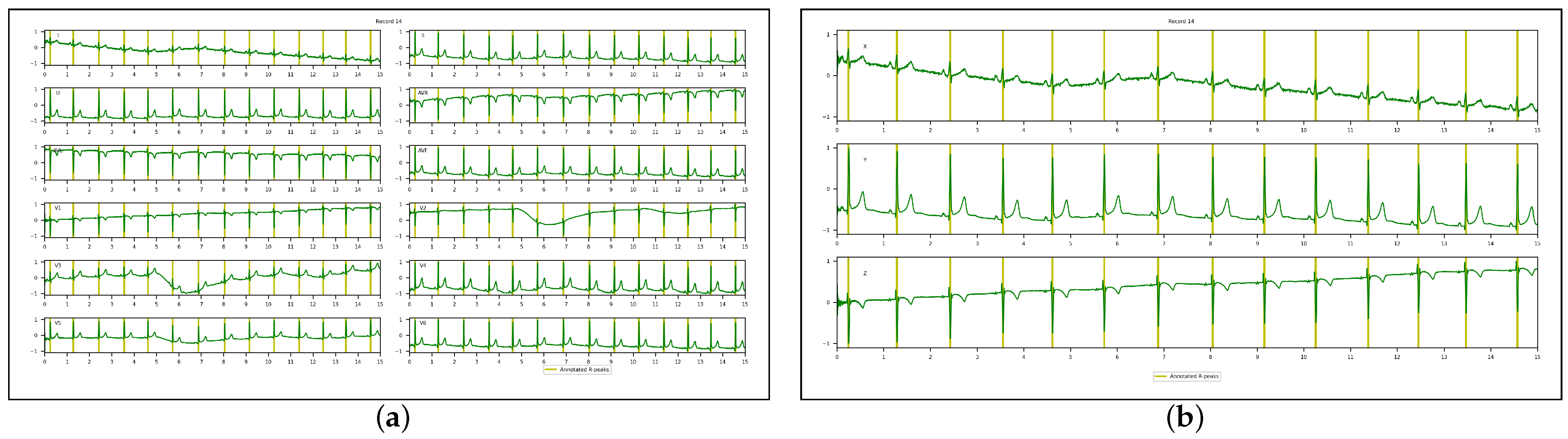 Sensors 23 02288 g002