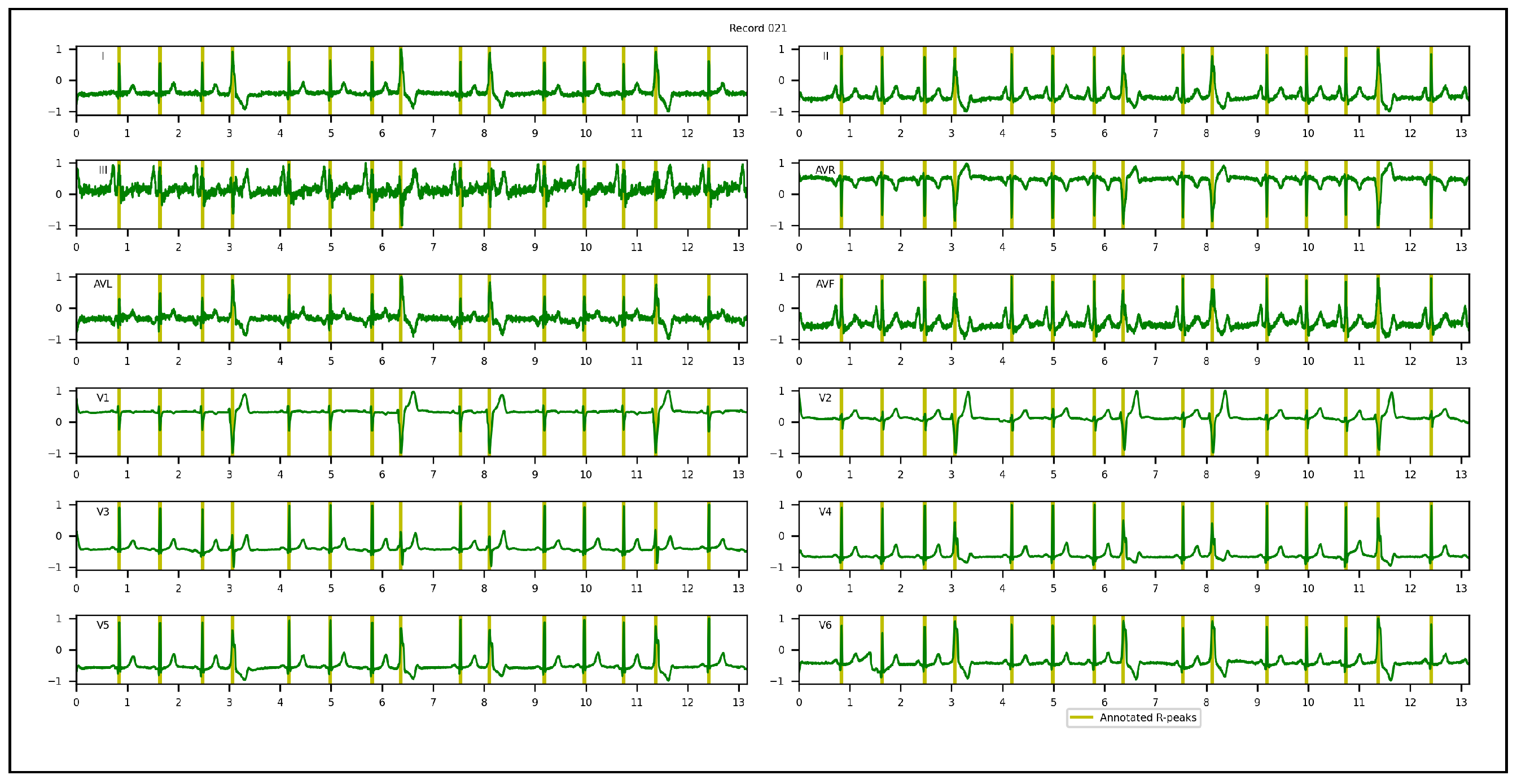 Sensors 23 02288 g004