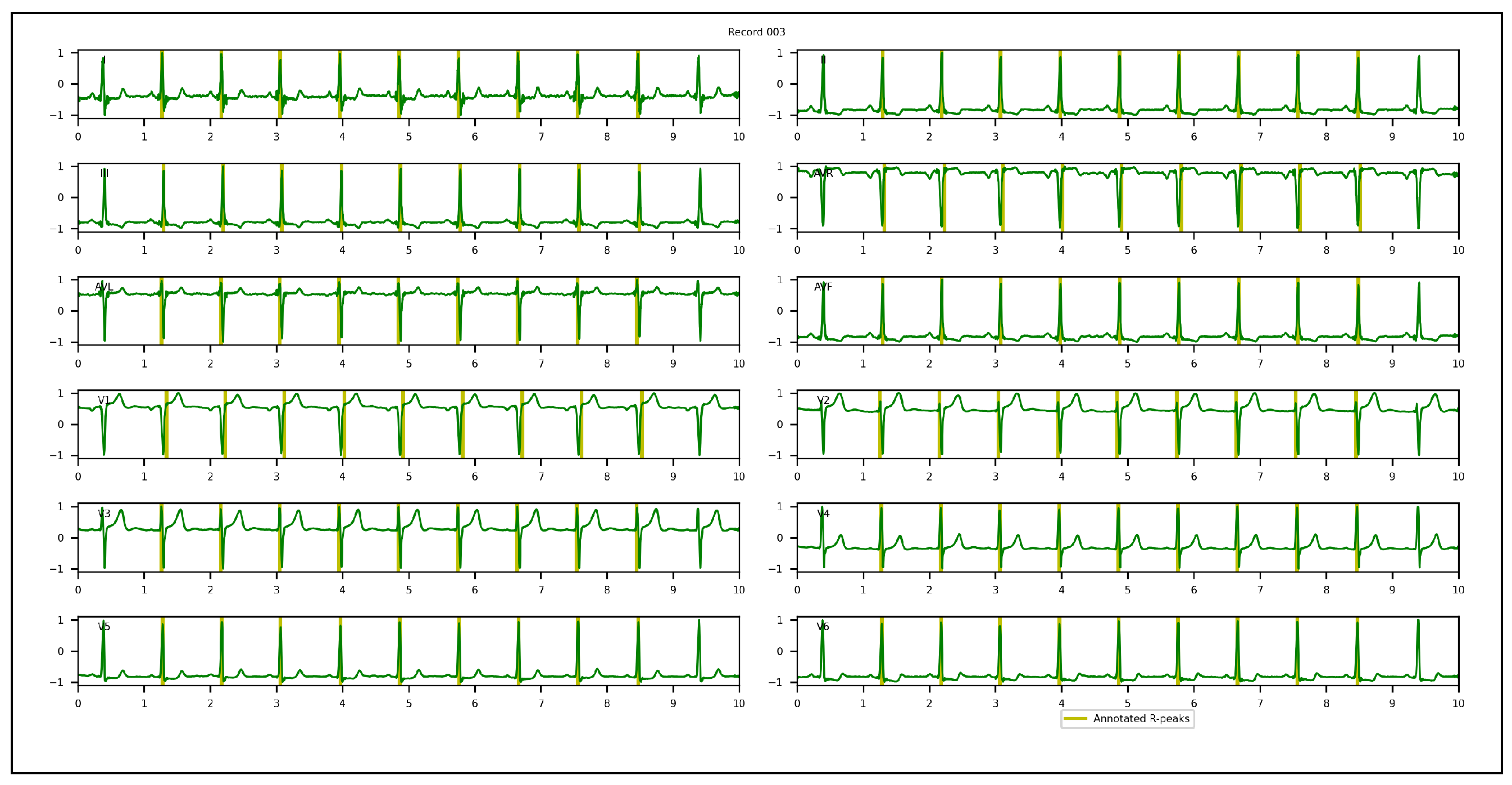 Sensors 23 02288 g005