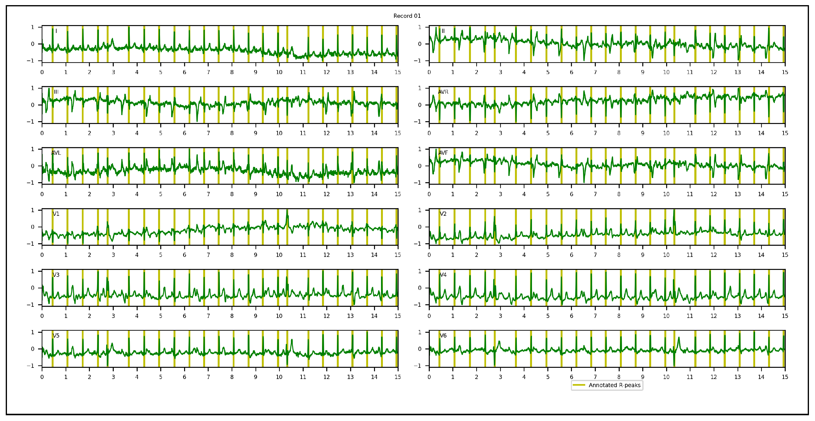Sensors 23 02288 g006
