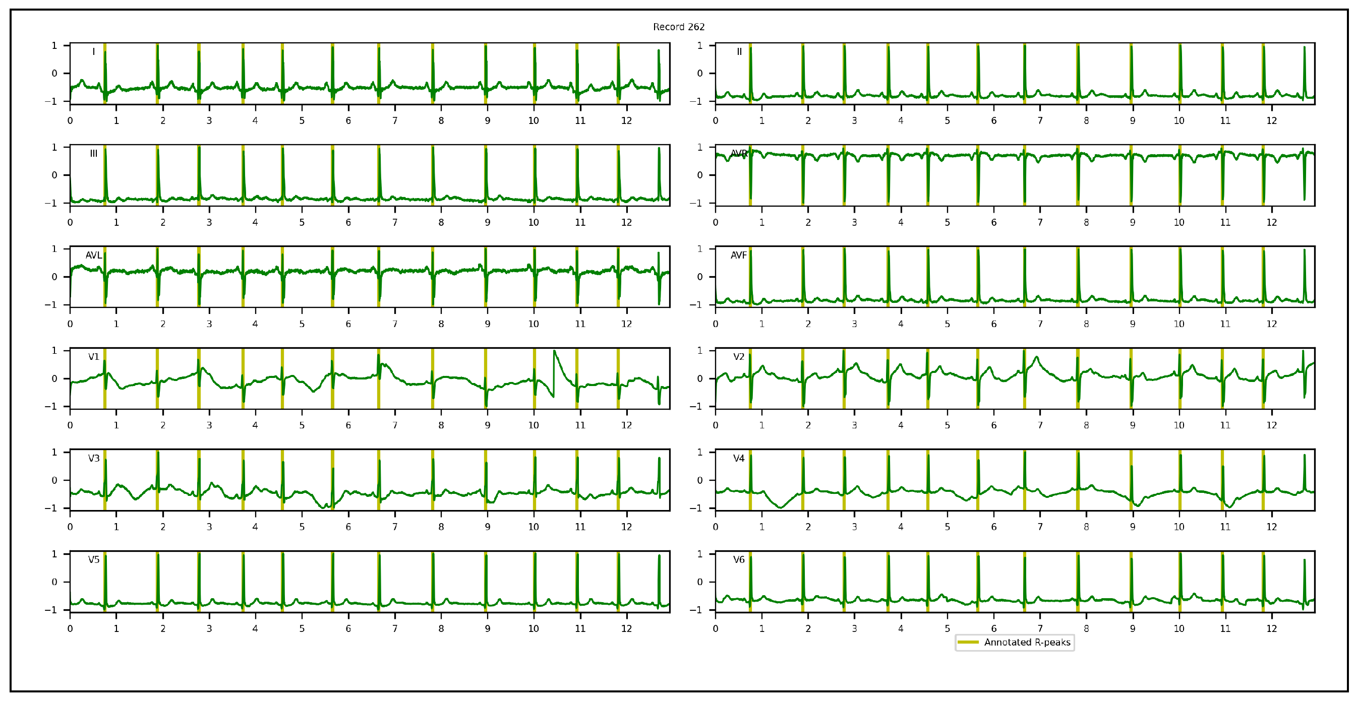 Sensors 23 02288 g007