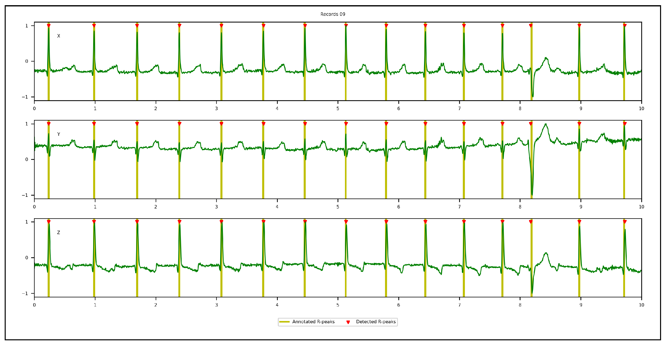 Sensors 23 02288 g011