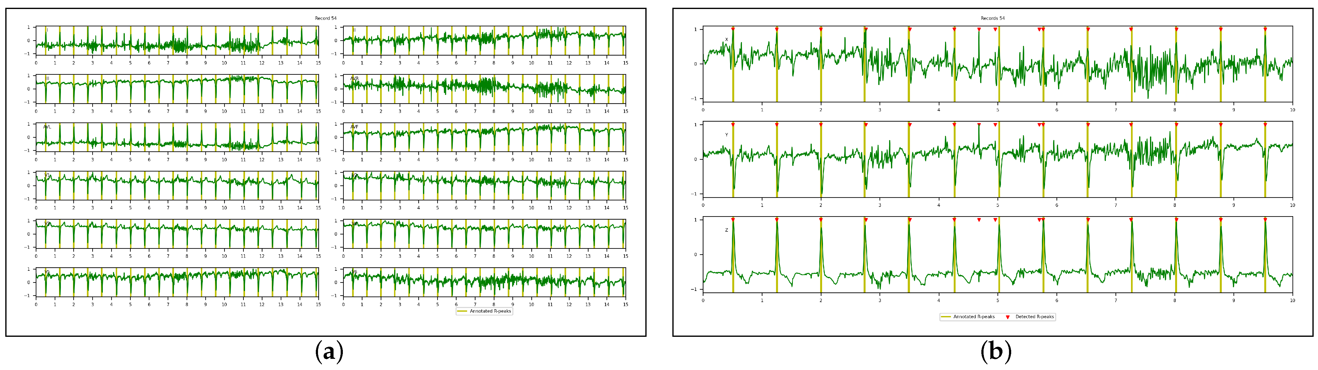 Sensors 23 02288 g013