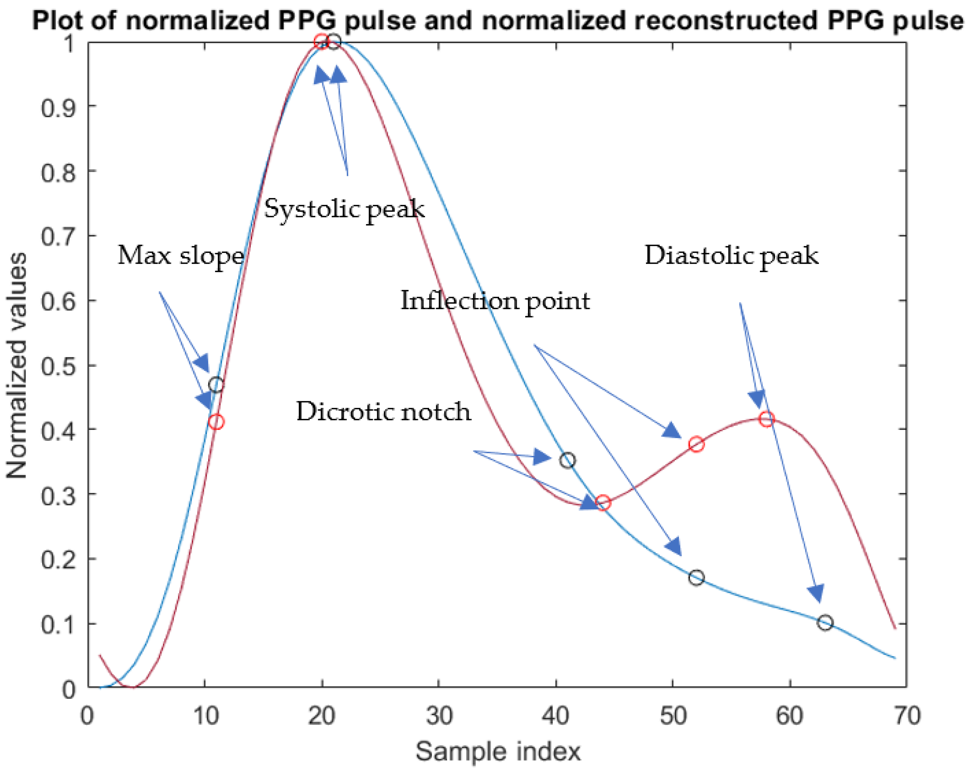 Sensors 23 02321 g005