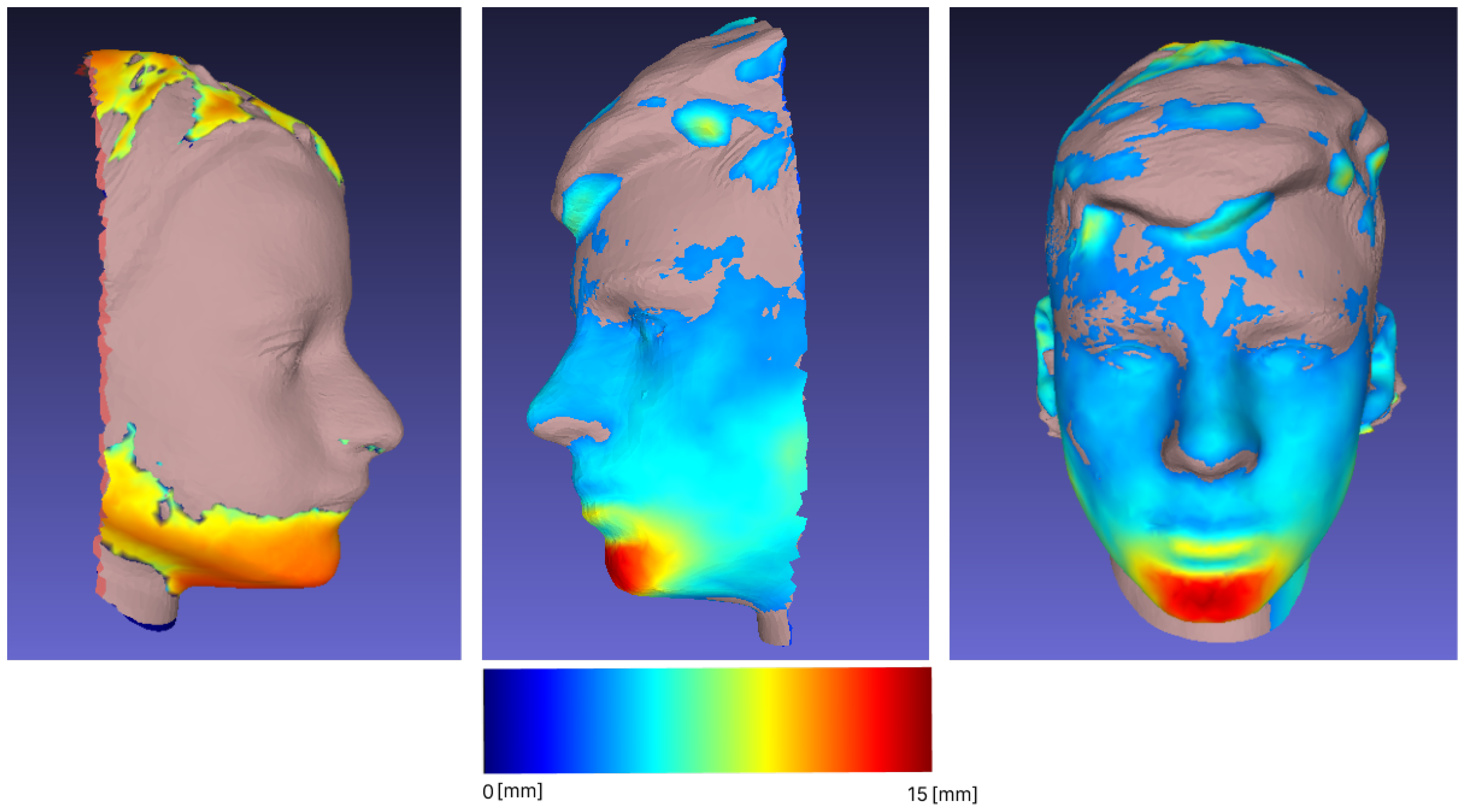 Sensors 23 02412 g006