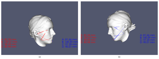 Sensors 23 02412 g0a2