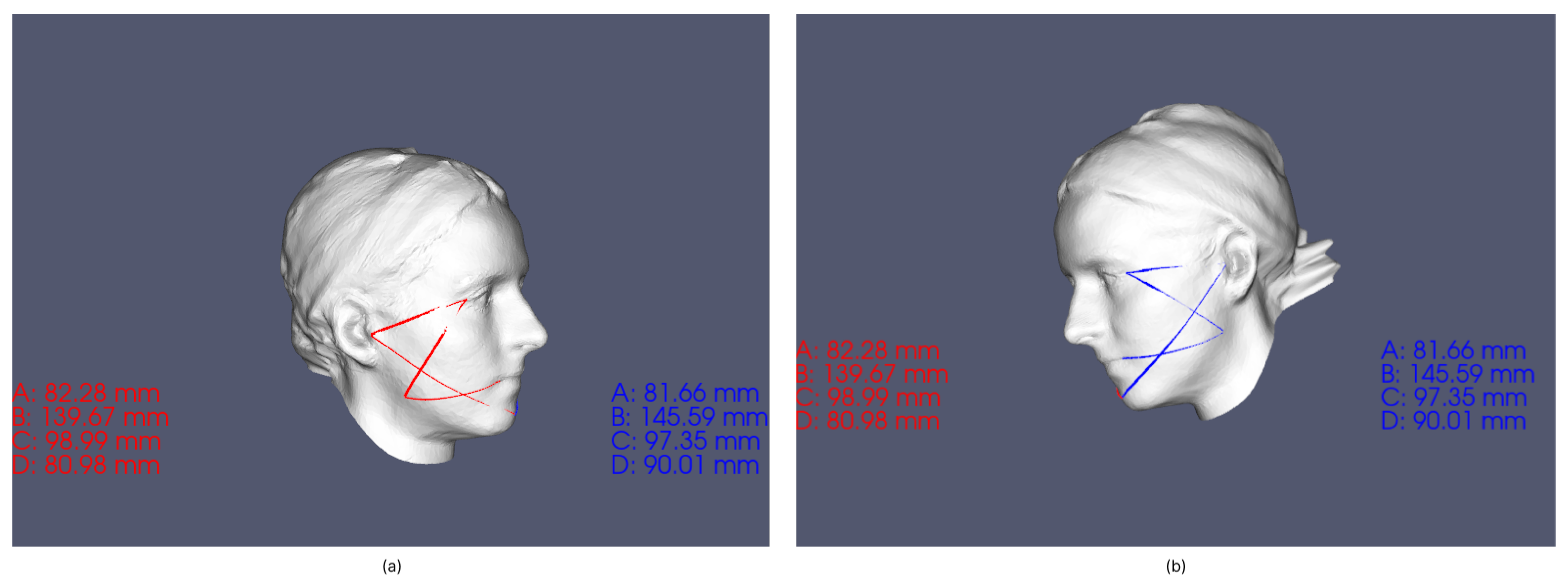 Sensors 23 02412 g0a2