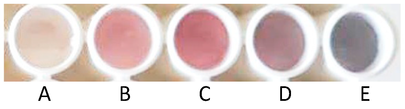 Sensors 23 02524 g003