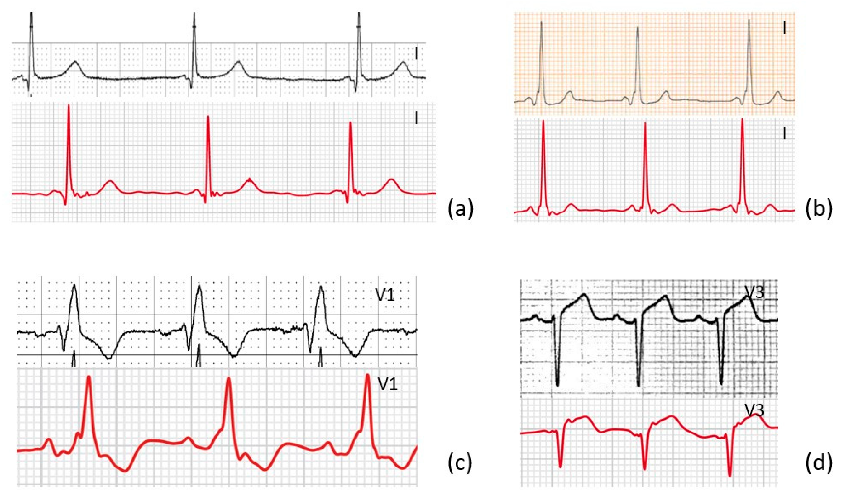 Sensors 23 02555 g006