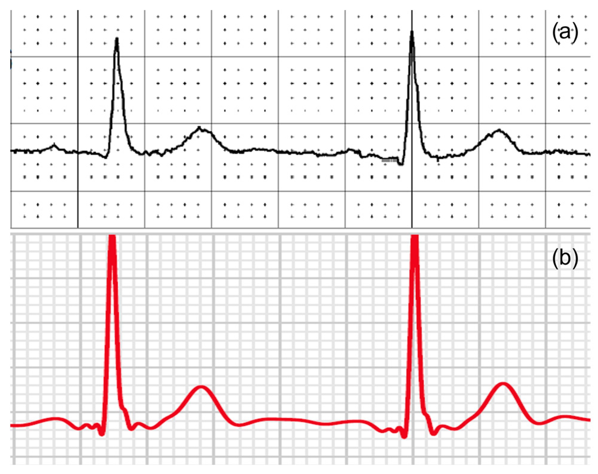 Sensors 23 02555 g007