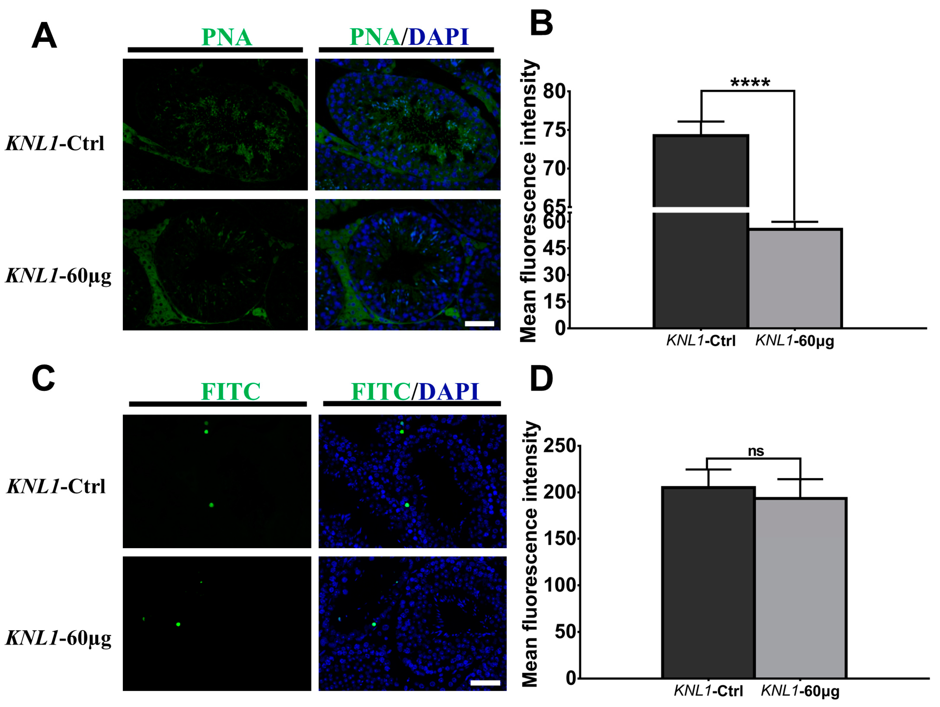 Sensors 23 02571 g005