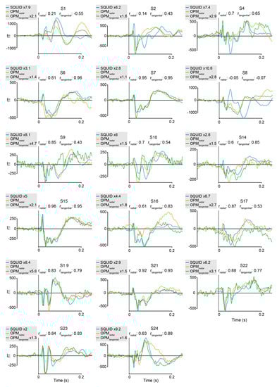 Sensors 23 02801 g0a1