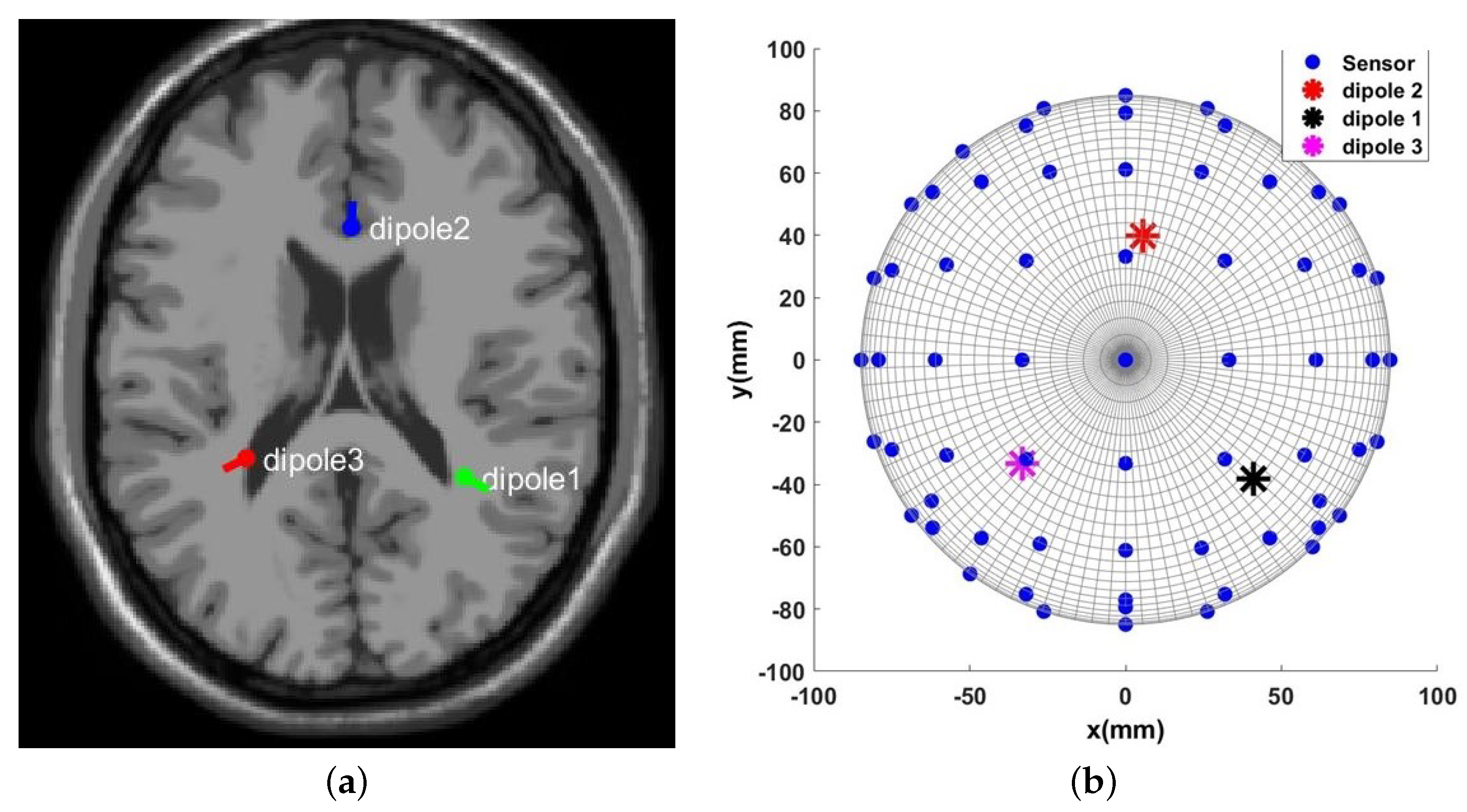 Sensors 23 02855 g016