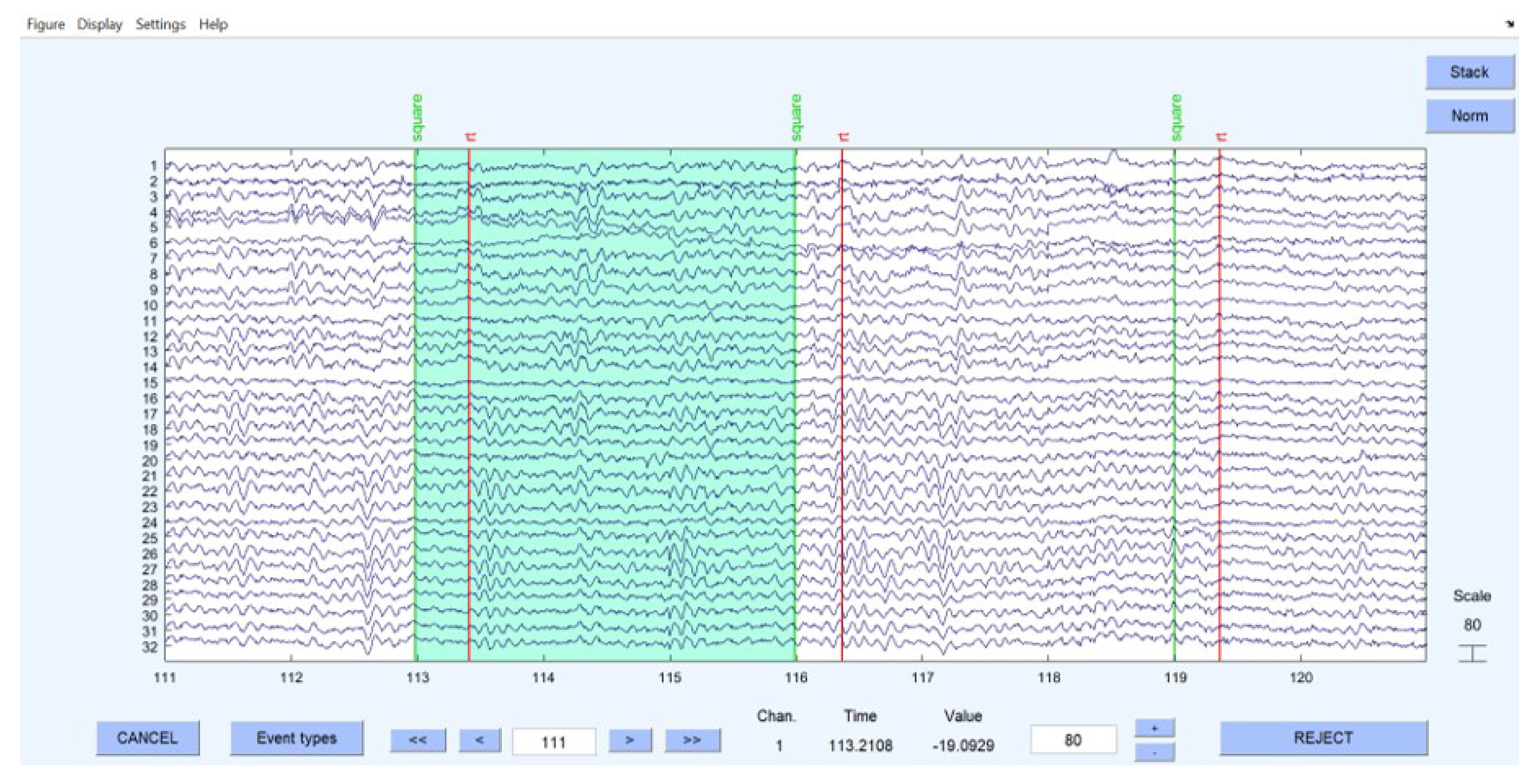 Sensors 23 02855 g017