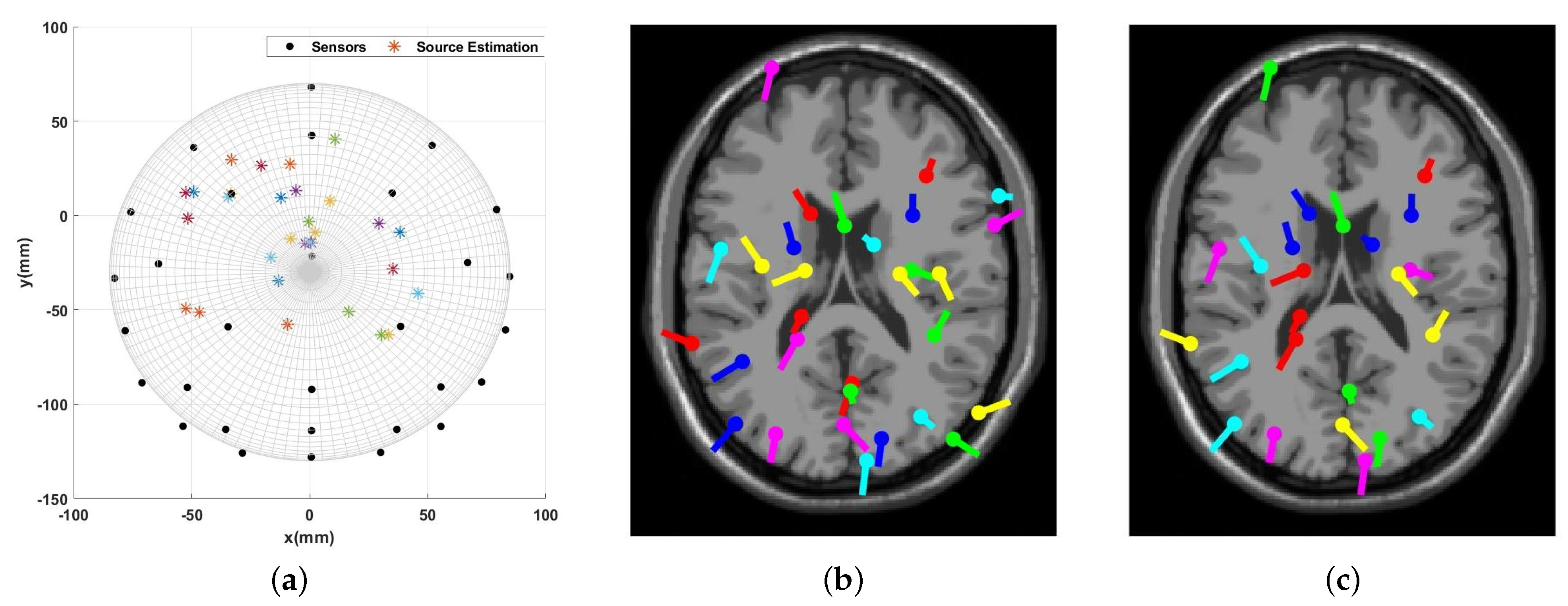 Sensors 23 02855 g018