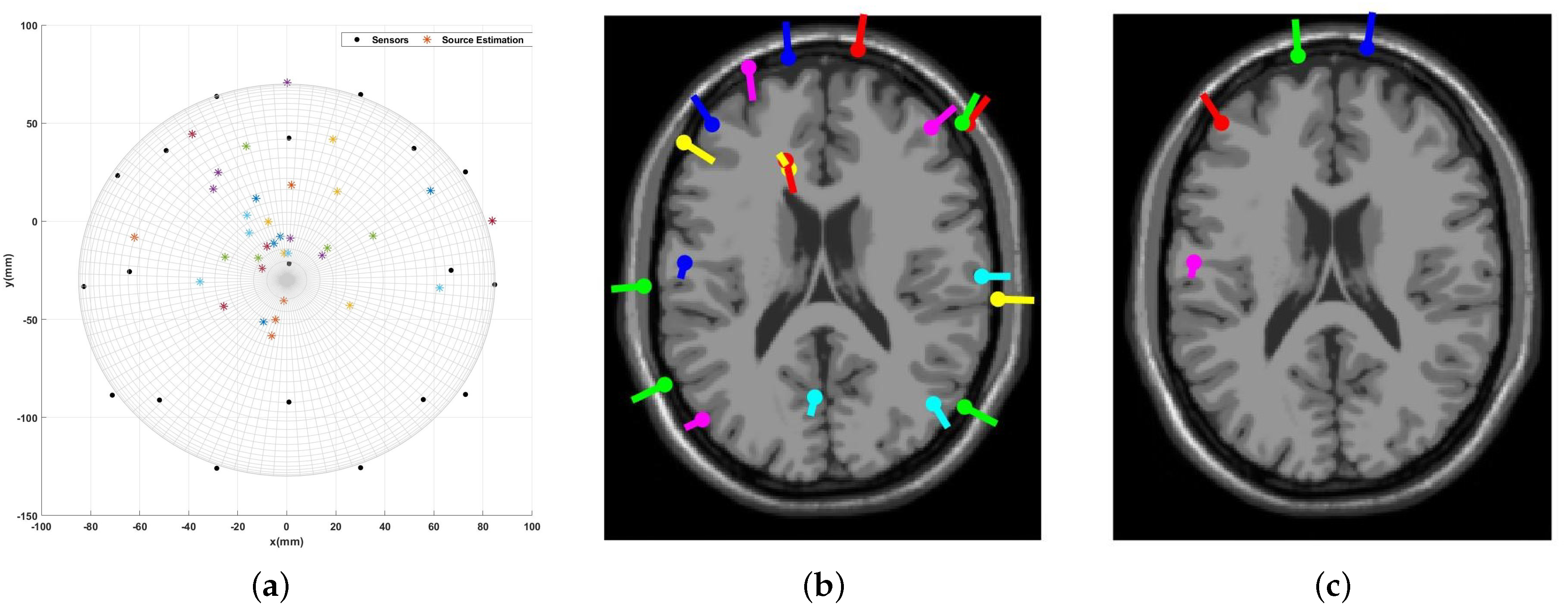 Sensors 23 02855 g023