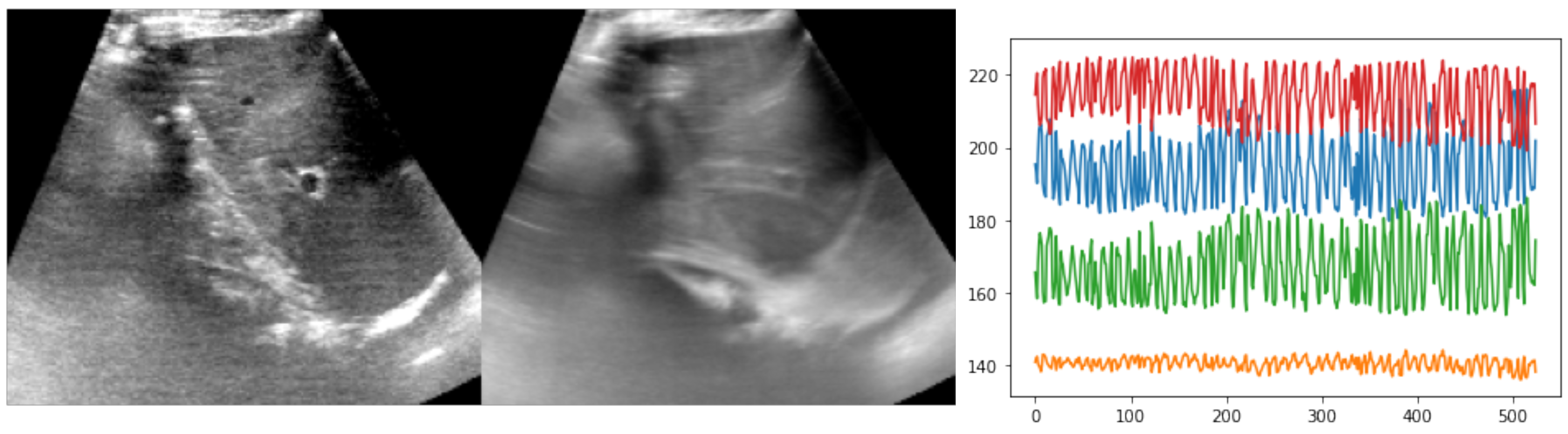 Sensors 23 02876 g004