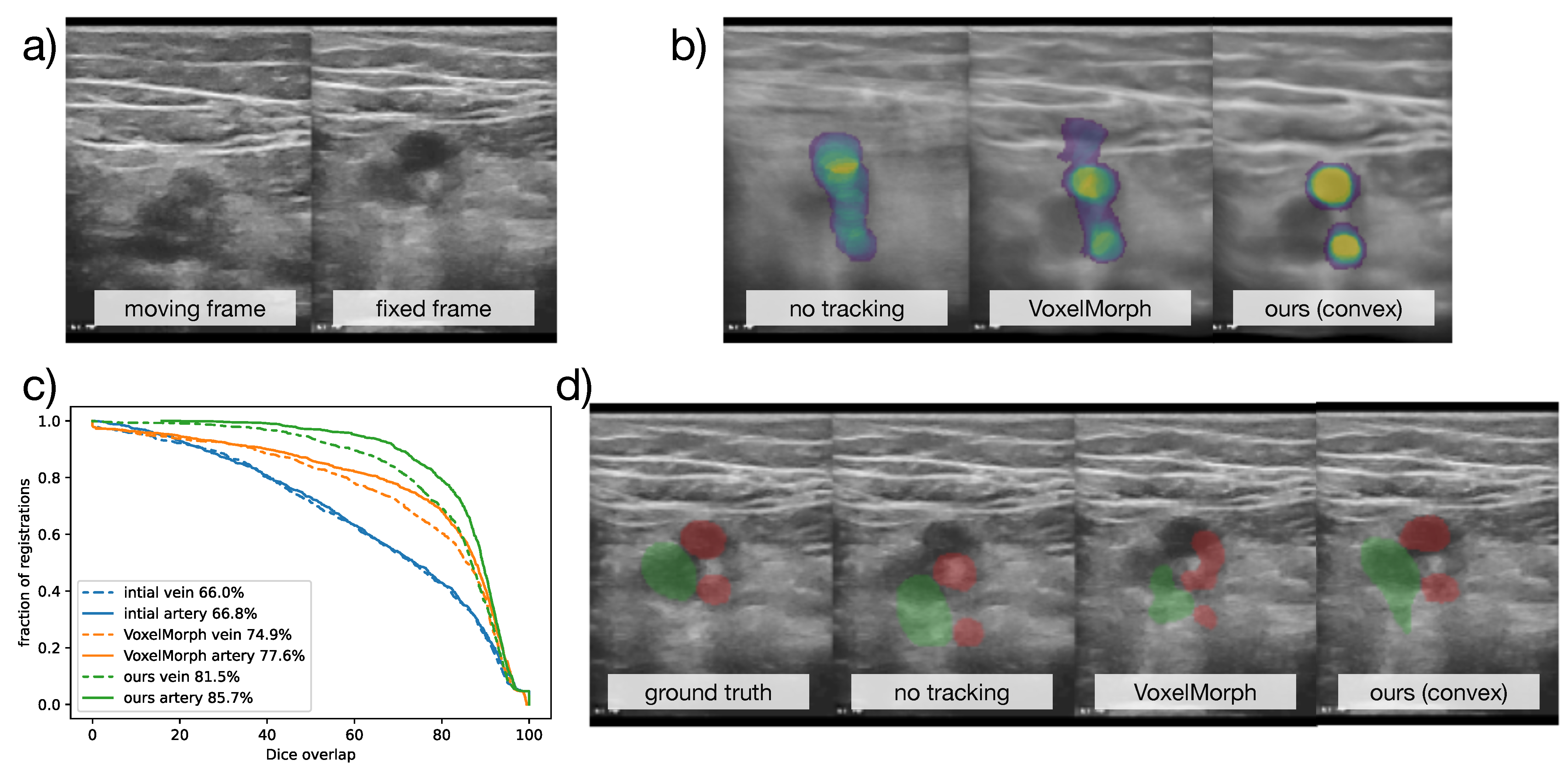 Sensors 23 02876 g006