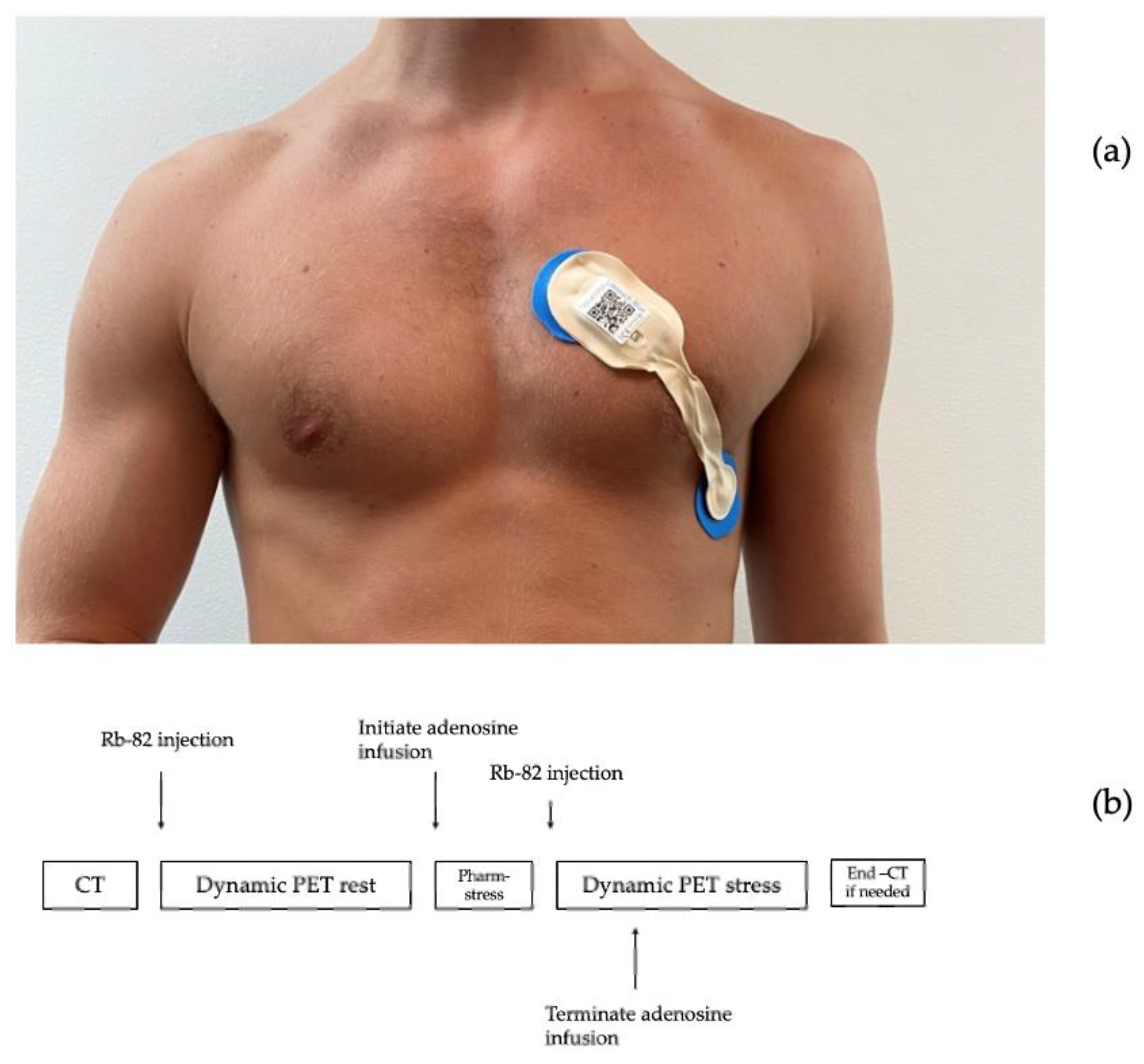 Sensors 23 02962 g001