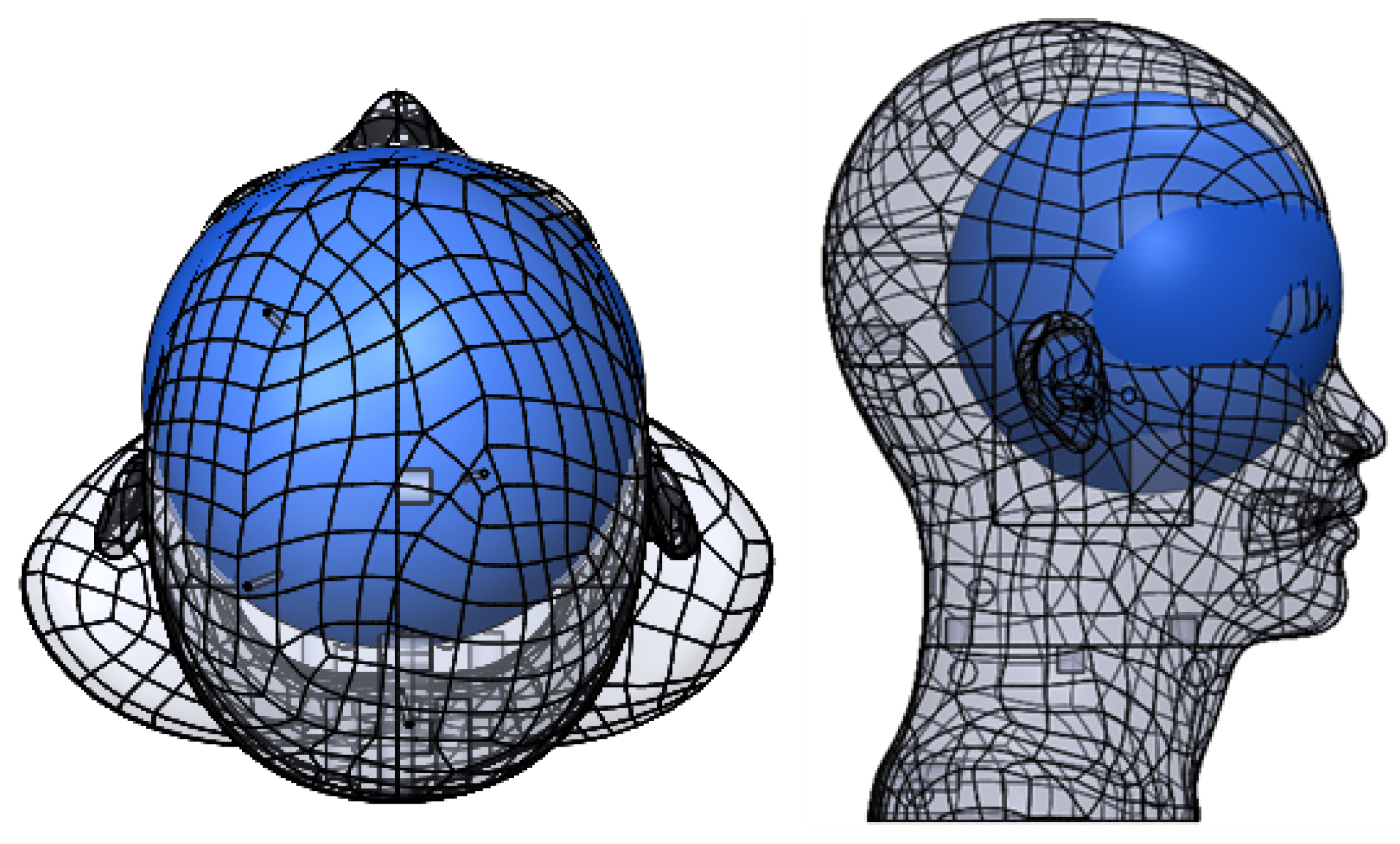 Sensors 23 02973 g005